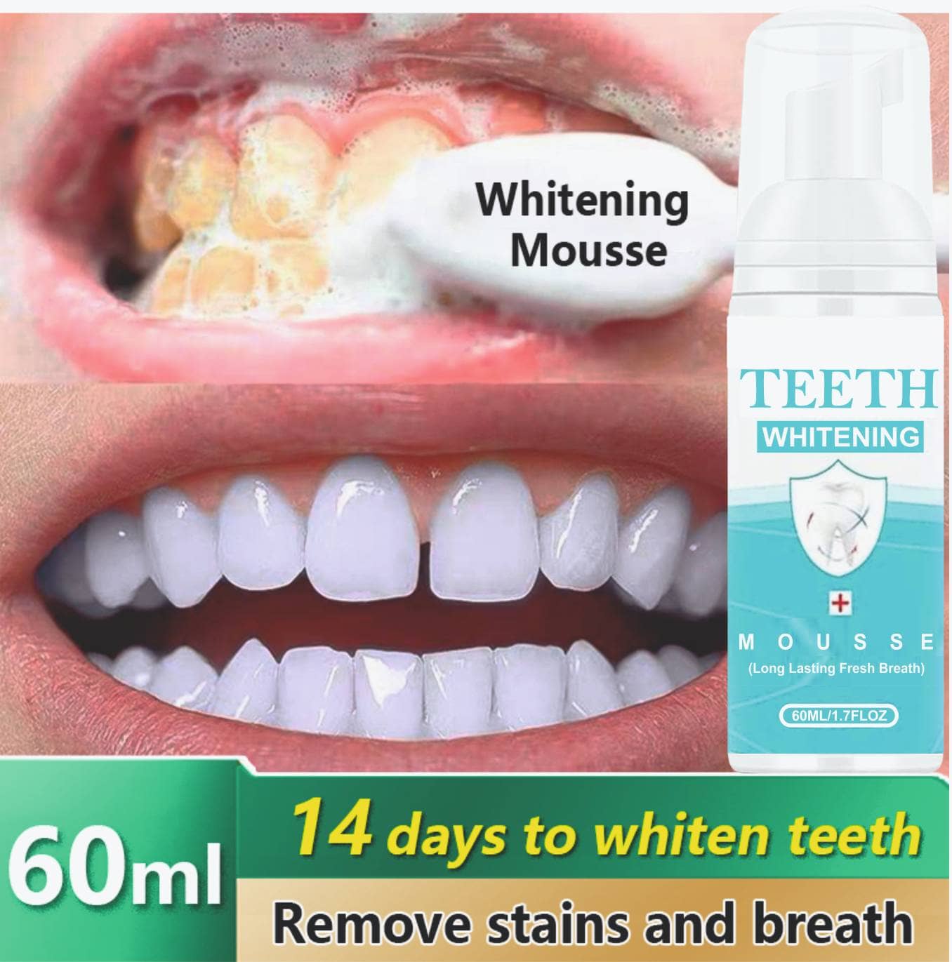 INDO CHALLENGE TEETH WHITENING Denture Oral Kit
