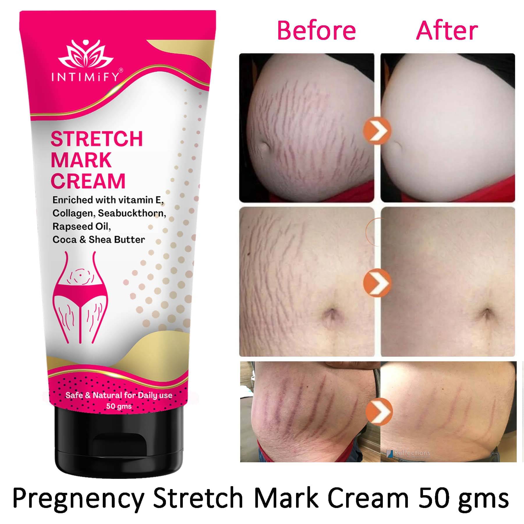 Intimify Stretch Mark Cream, Scar Cream, Stretch Mark Remover Shaping & Firming Cream 50 g Intimify Stretch Mark Cream, Scar Cream, Stretch Mark Remover Shaping & Firming Cream 50 g
