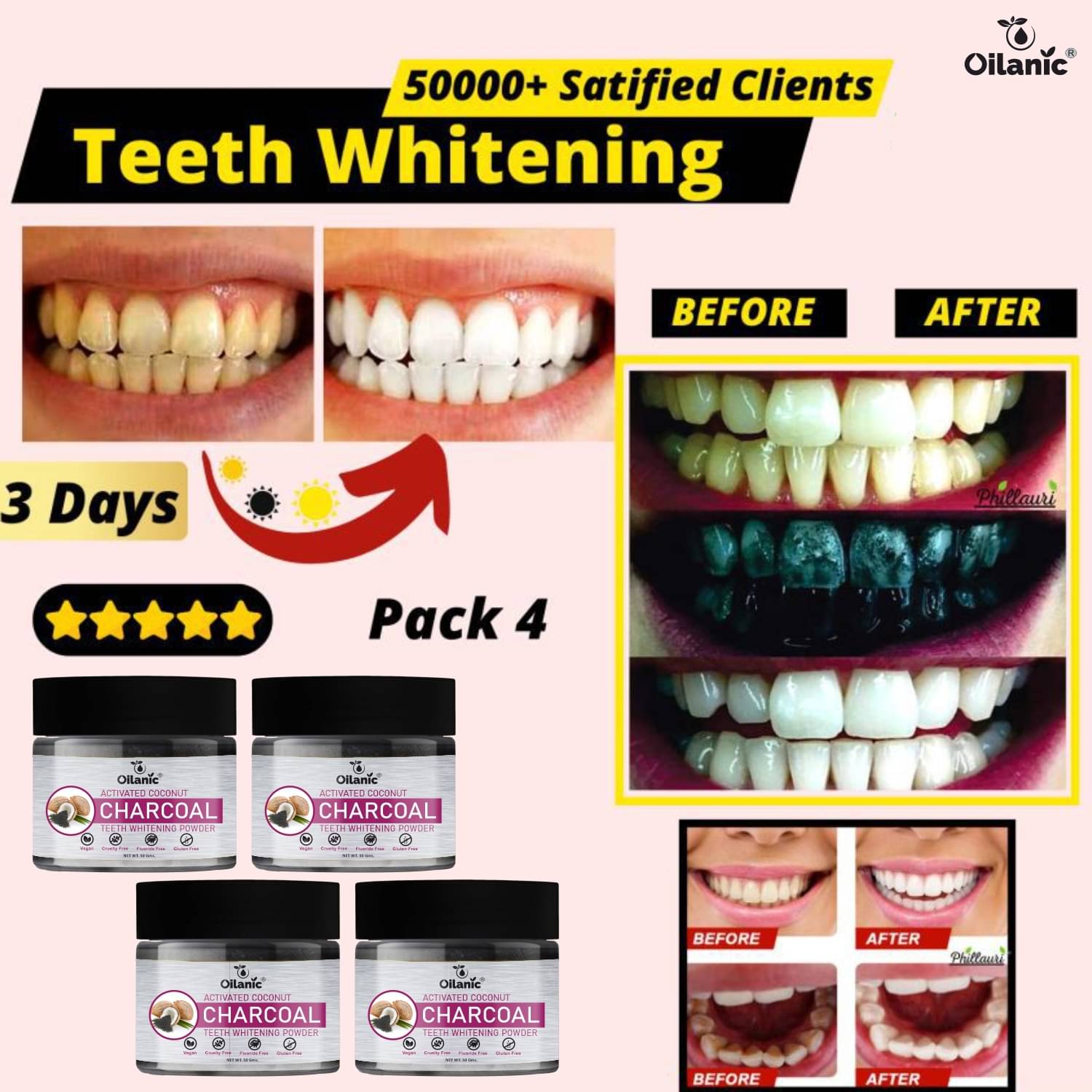     			Oilanic Coconut Shell Charcoal Teeth Whitening Powder Denture Oral Kit Pack of 4