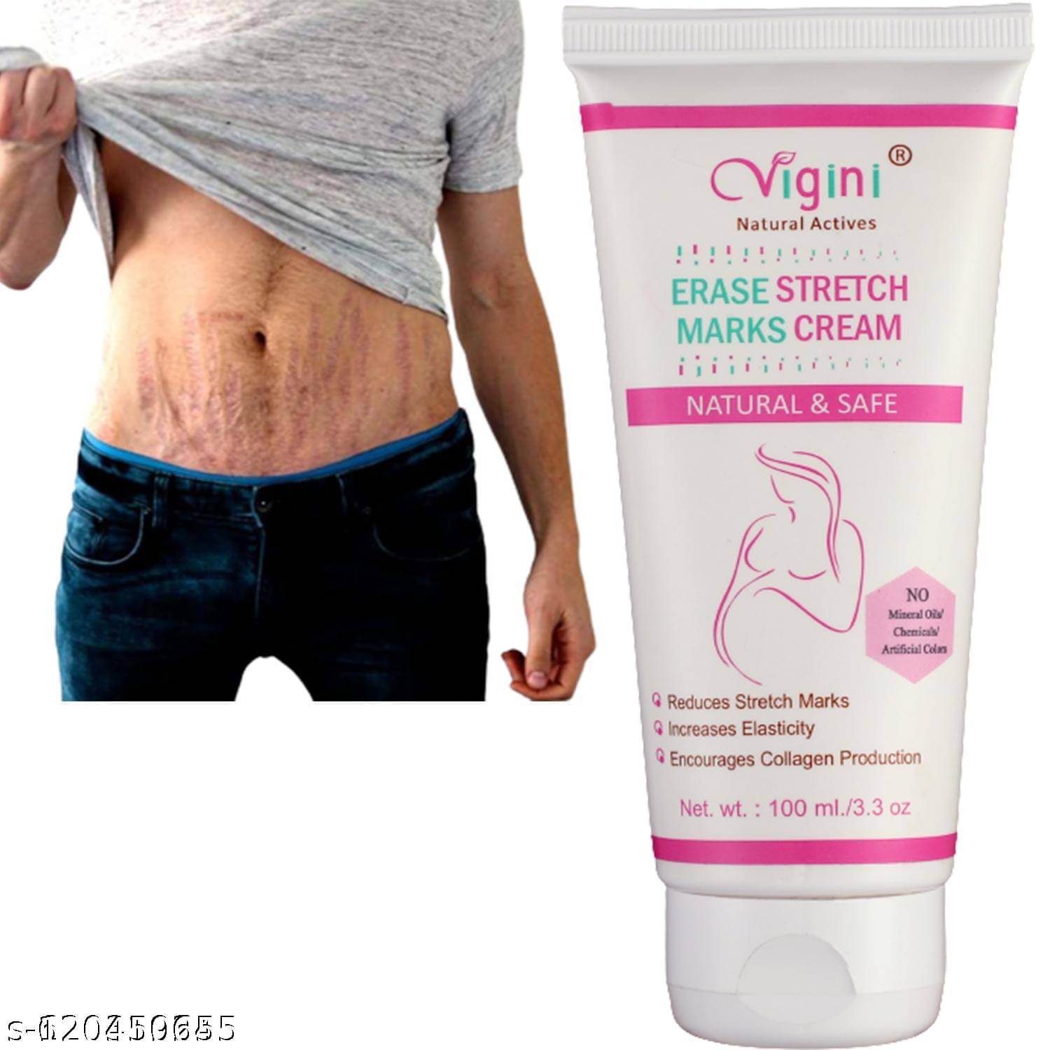     			Vigini Stretch Marks Scars Removal Shaping & Firming Cream 100 g