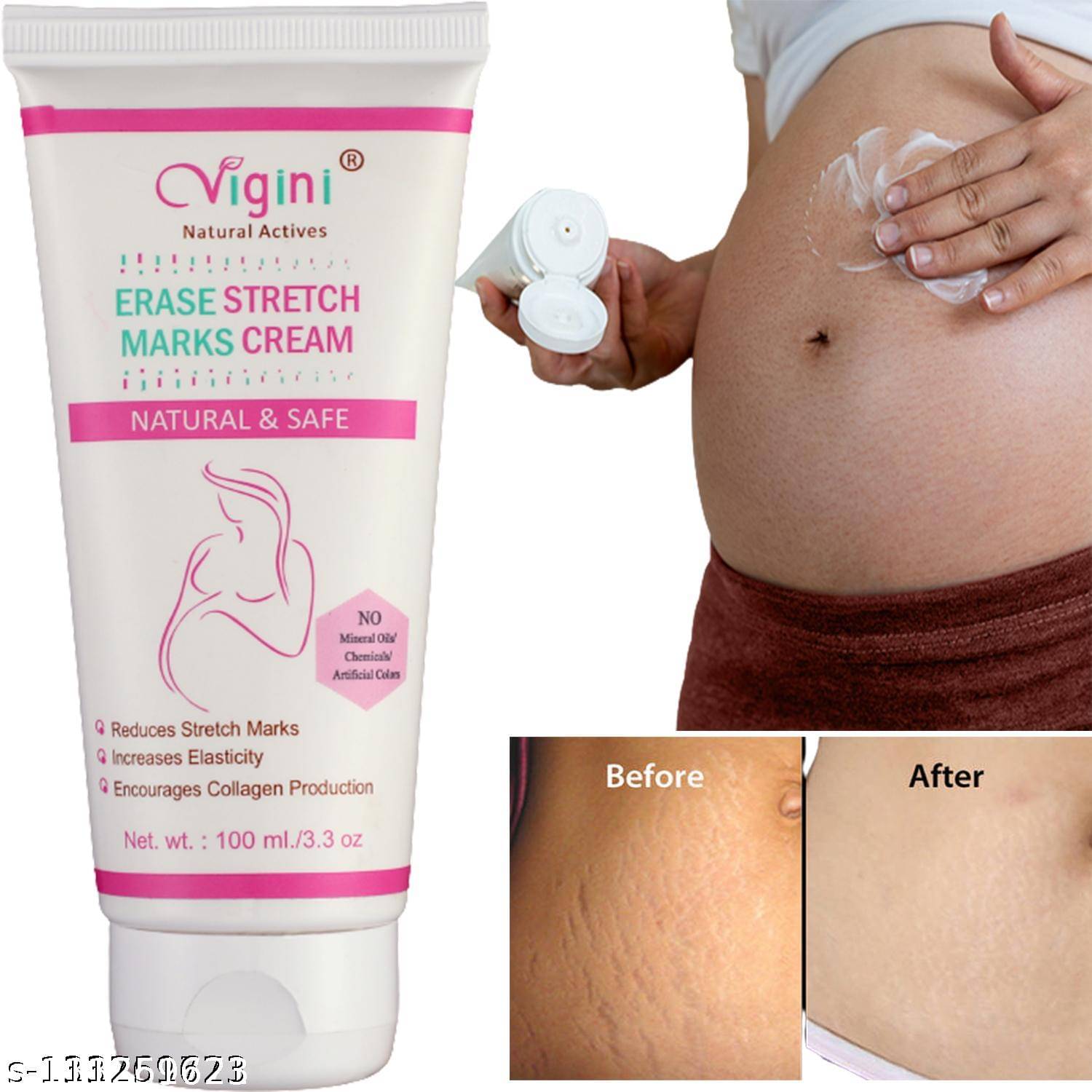     			Vigini Stretch Marks Scars Removal Cream