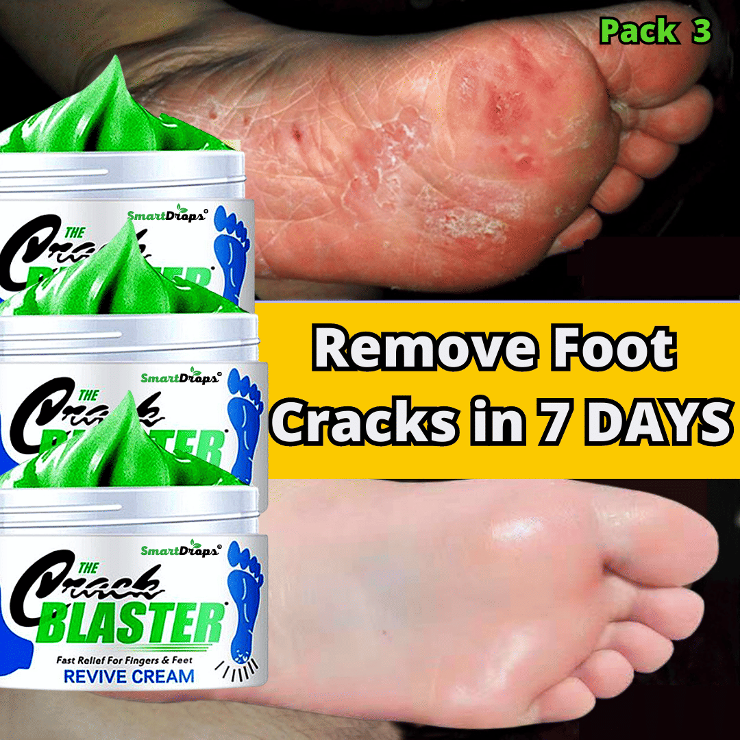 Smartdrops Cracked Heel Repair Cream Feet Cream Foot Cream SPF 15 ( 50 g )
