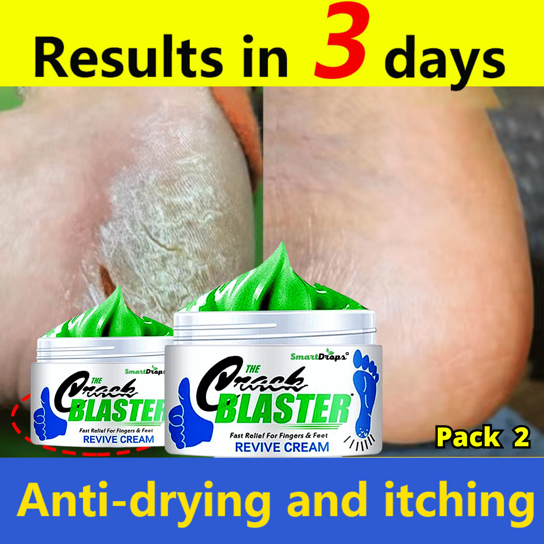 Smartdrops Softens For Dry & Cracked Feet Foot Cream Foot Cream ( 100 g ) Pack of 2 Smartdrops Softens For Dry & Cracked Feet Foot Cream Foot Cream ( 100 g ) Pack of 2