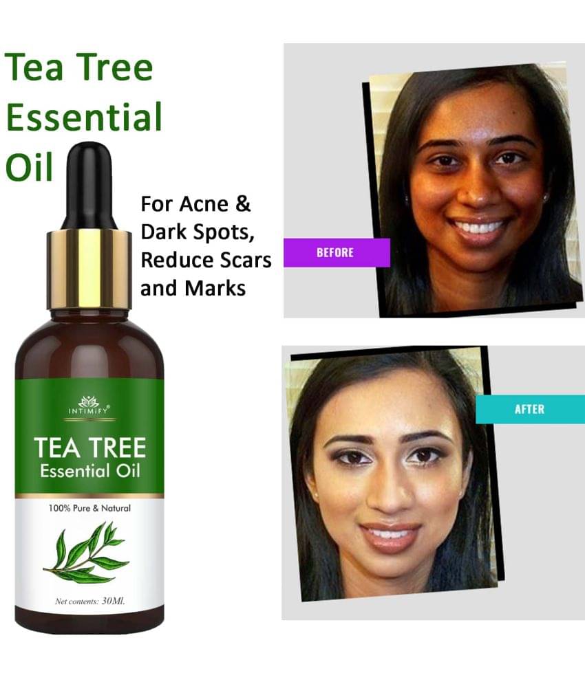 Intimify Tea Tree Essential Oil, Acne Removal Face Oil, Face Oil For Skin Whitening - 30ml Intimify Tea Tree Essential Oil, Acne Removal Face Oil, Face Oil For Skin Whitening - 30ml