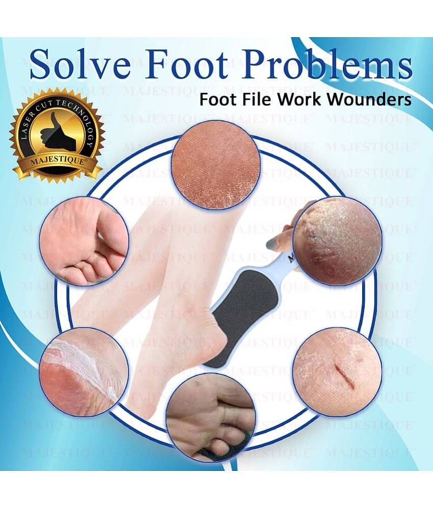 Majestique Foot Scrubber - Callus Remover & Pedicure Tool for Wet & Dry Feet - 2 Pcs Color May Vary