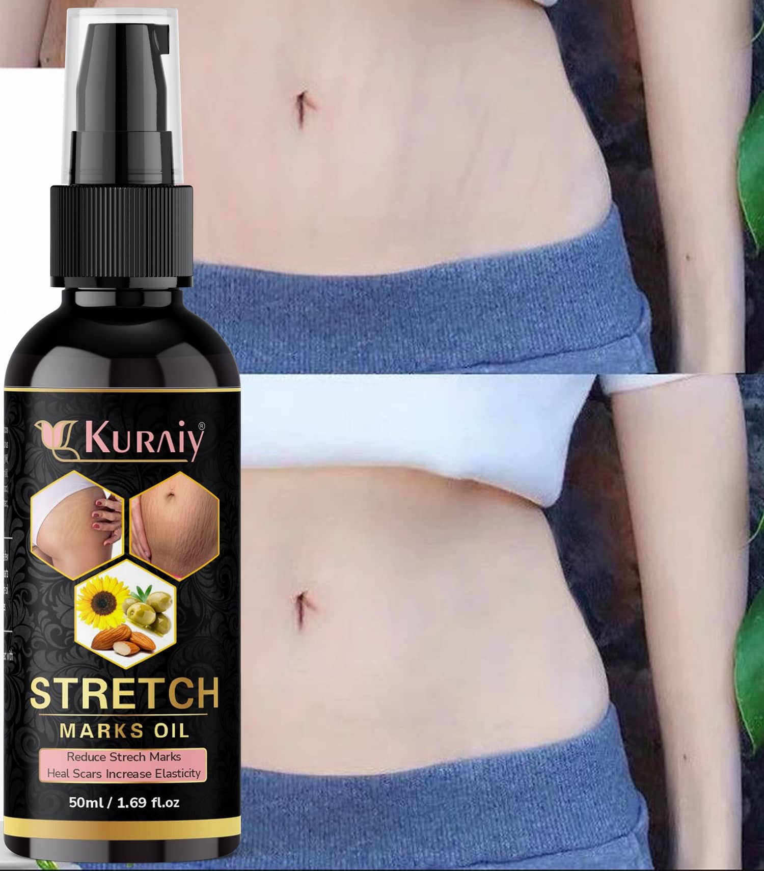 Kuraiy Natural Stretch Oil with Coconut, Olive & Jojoba Oils, For Scars & Stretchmark Oil