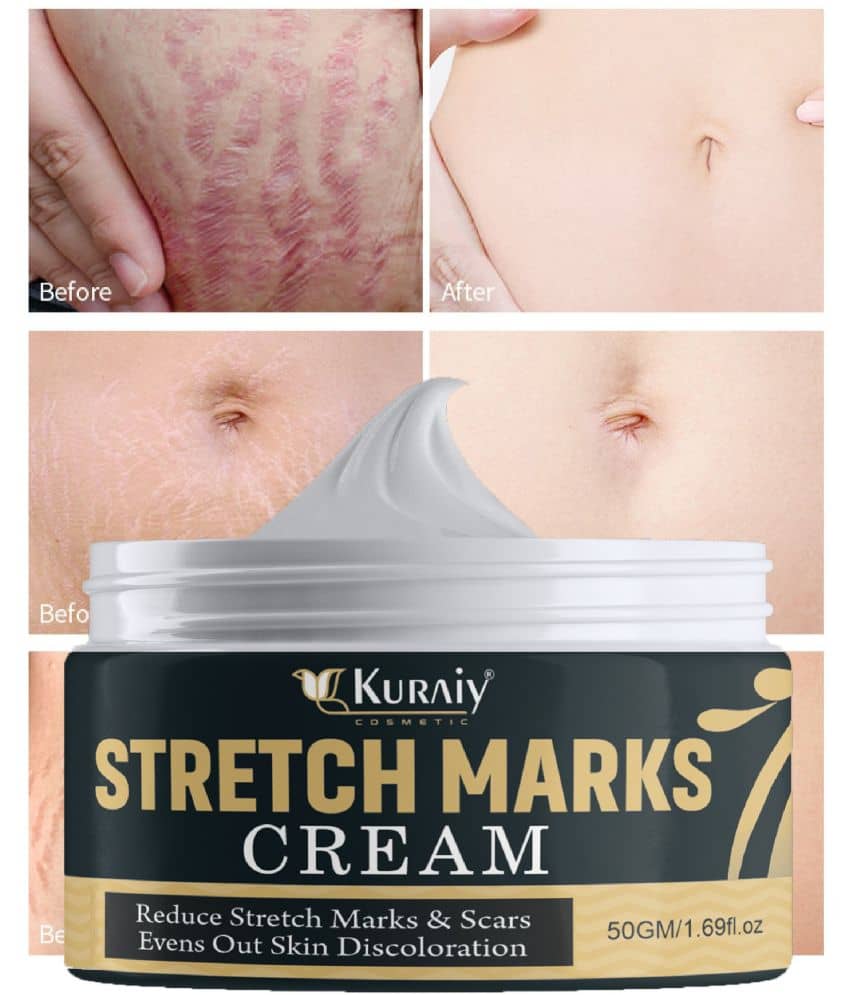 Kuraiy Natural Stretch Oil with Coconut, Olive & Jojoba Oils, For Scars & Stretchmark Oil