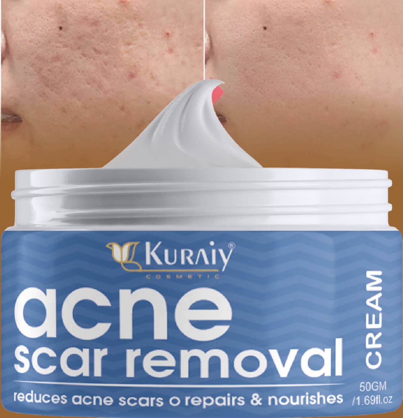 KURAIY Acne Face Cream Herbal Pimple Scar Removal Shrink Pore Oil Control Facial Cream