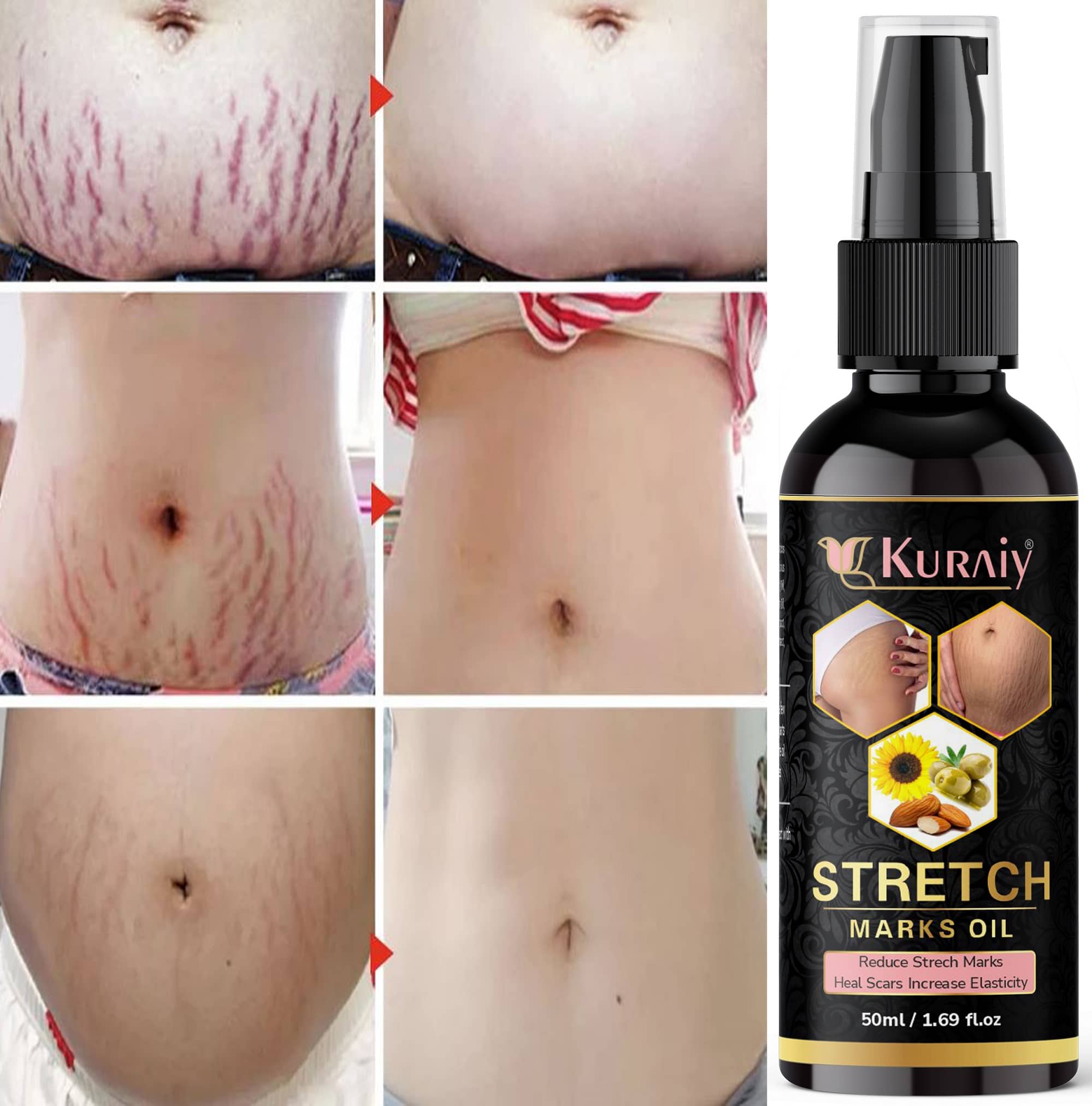 Kuraiy Natural Stretch Oil with Coconut, Olive & Jojoba Oils, For Scars & Stretchmark Oil