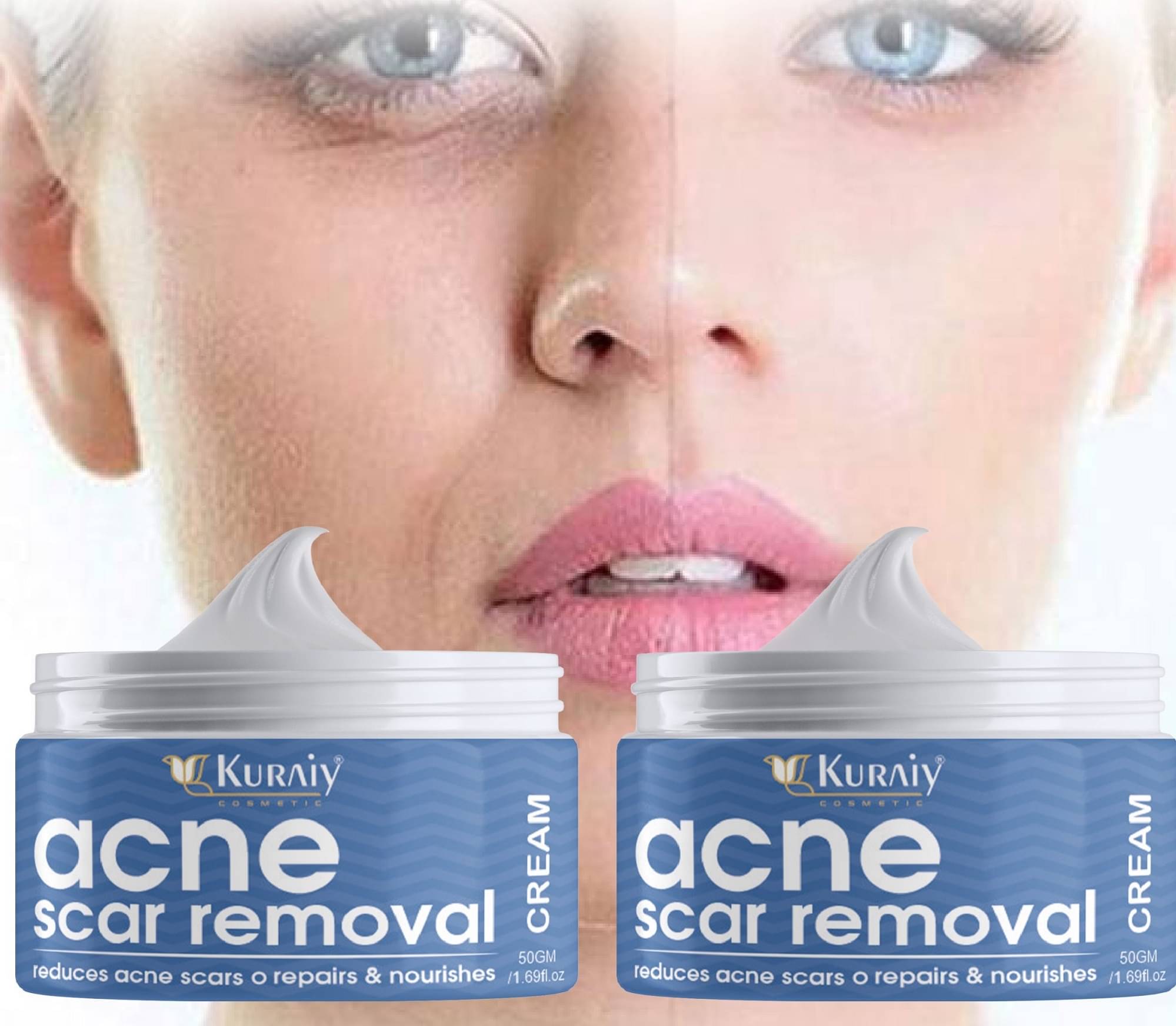     			KURAIY Scar Removal Cream Repair Stretch Marks Burn Acne Scar Pack of 2