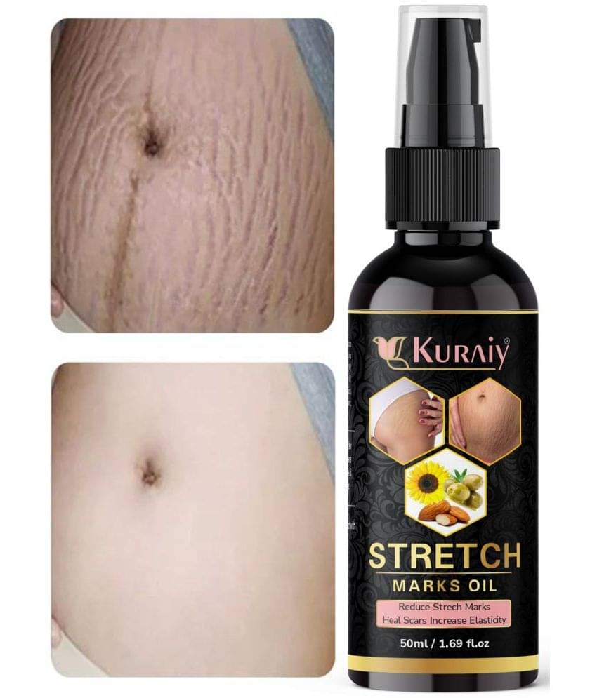     			KURAIY Remove Pregnancy Mark Body Cream Treatment Scars Acne Stretch Marks Cream