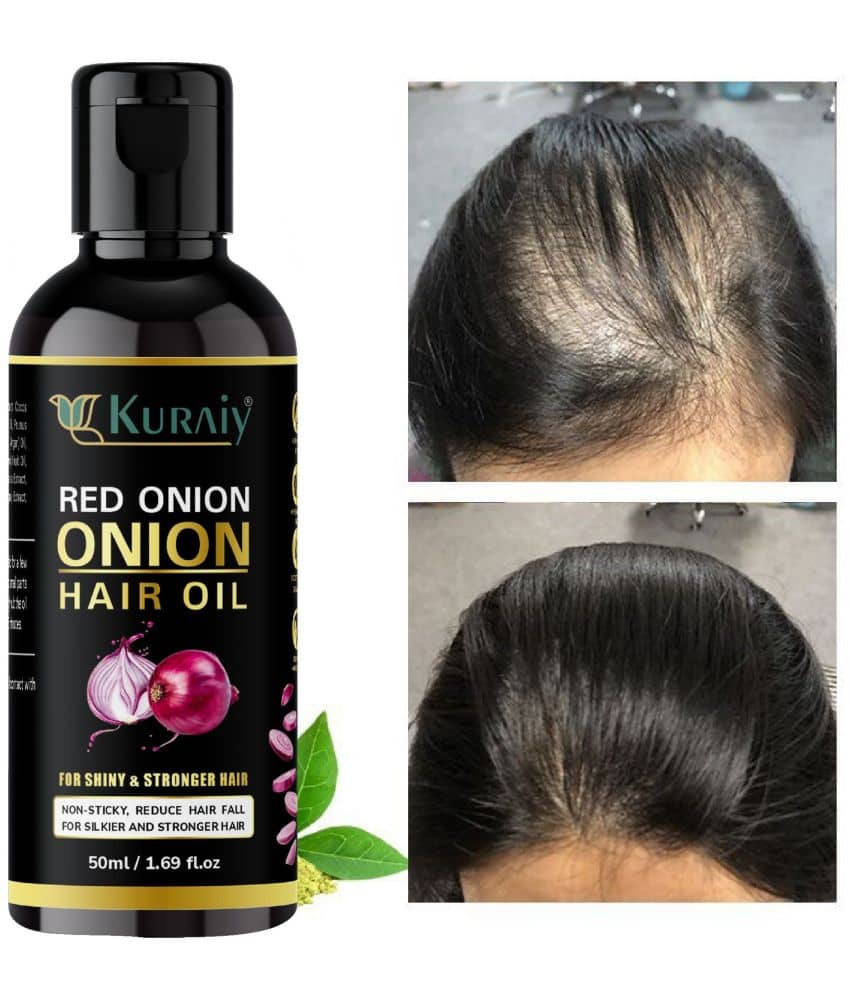 KURAIY ONION All Type of Hair Problem Herbal Anti Dandruff Hair Oil 50 ML Hair Oil PACK OF 2