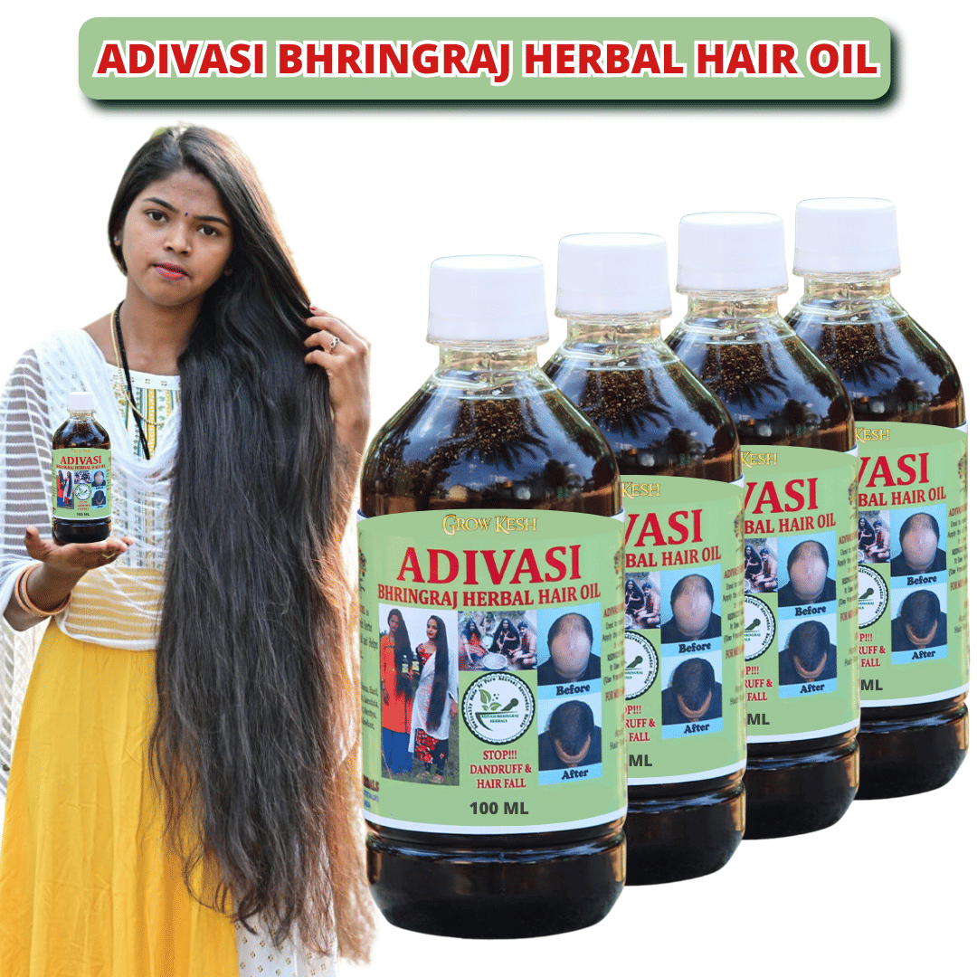 Growkesh - Anti Dandruff Aloe vera Oil 400 ml ( Pack of 4 )