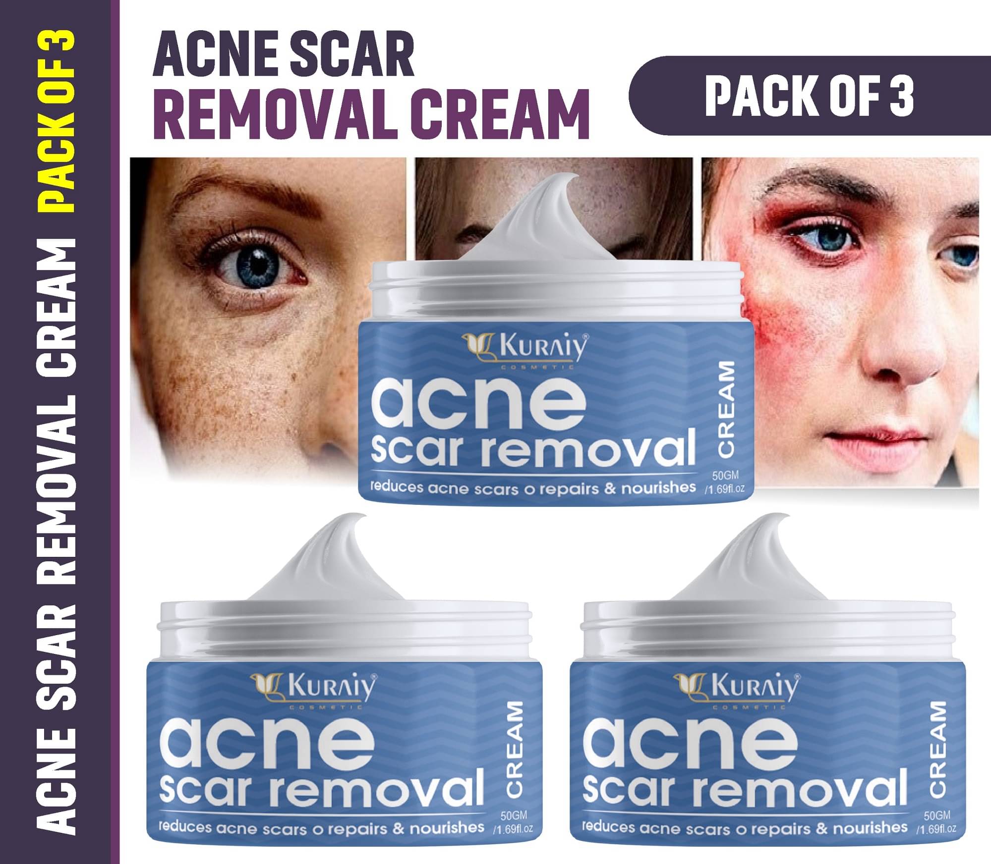     			KURAIY Scar Removal Cream Gel Remove Acne Spots Treatment Pack of 3