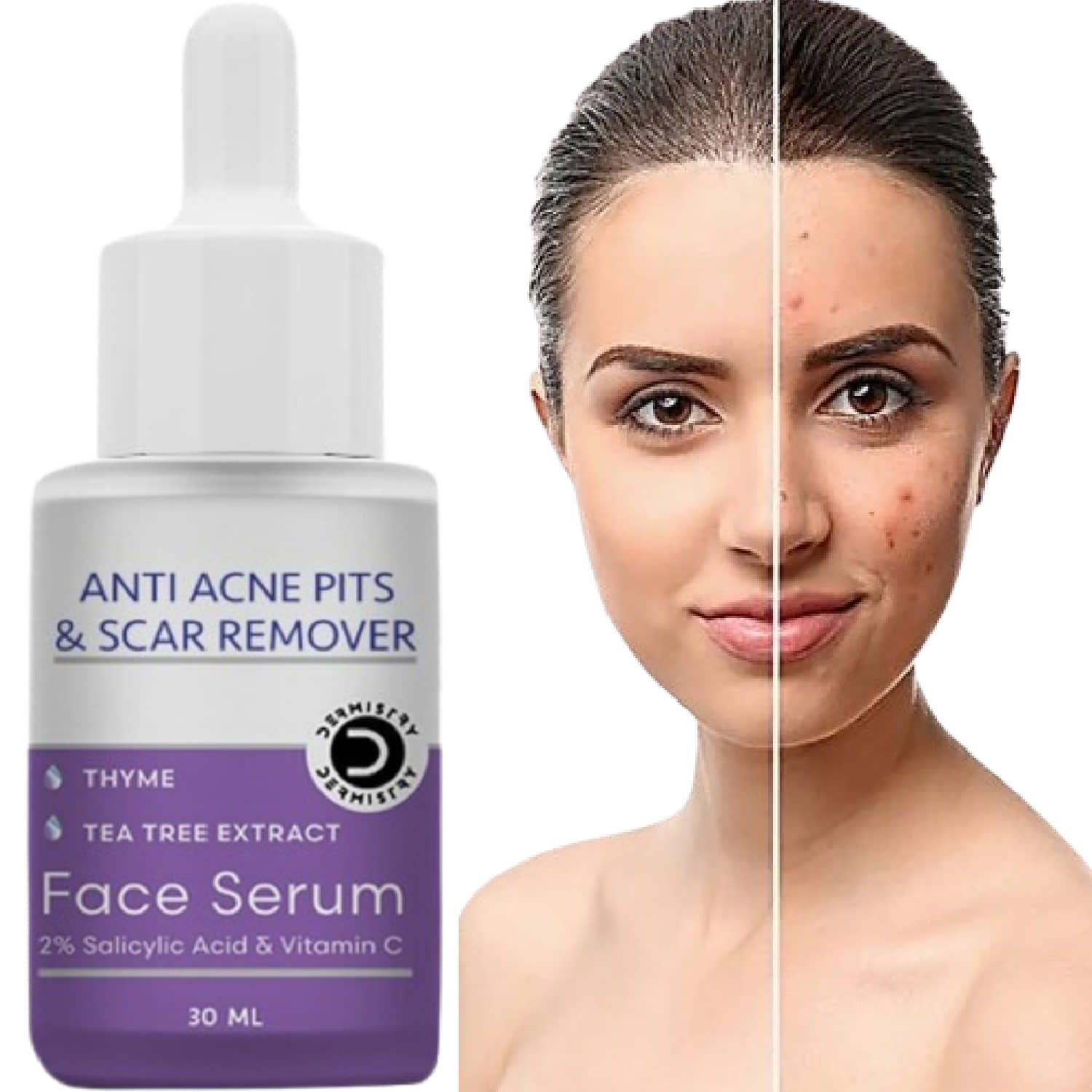 Dermistry Anti Acne 2% Salicylic Acid Niacinamide Vitamin C Oil Control Face Serum for Acne Prone Oily Skin Fight Pimples Blackheads Whitehead Pits Scars Spots Remover Open Pores Men Women Use Soap Body Wash Removal Pigmentation Cream Gel Facial Kit Pack