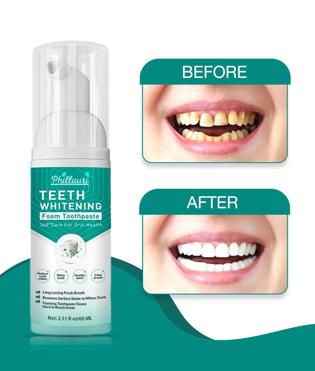 Phillauri Teeth Whitening Denture Oral Kit Phillauri Teeth Whitening Denture Oral Kit