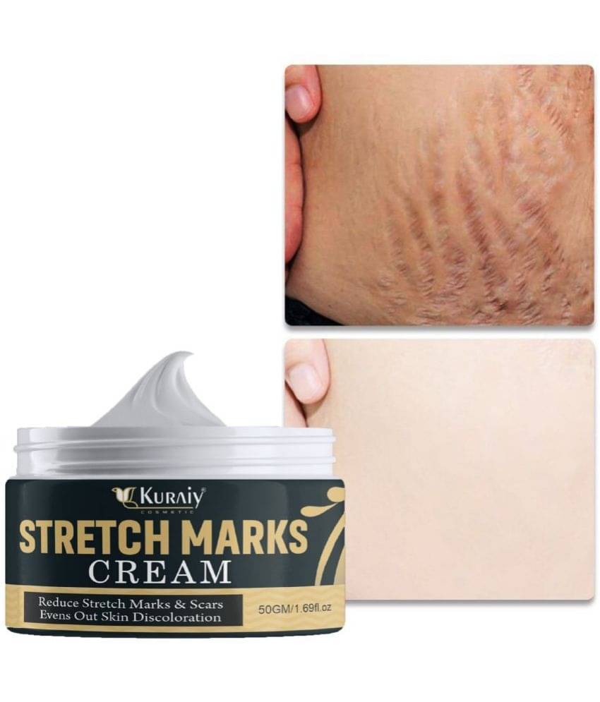 KURAIY Remove Pregnancy Mark Body Cream Treatment Scars Acne Stretch Marks Cream Maternity Repair KURAIY Remove Pregnancy Mark Body Cream Treatment Scars Acne Stretch Marks Cream Maternity Repair