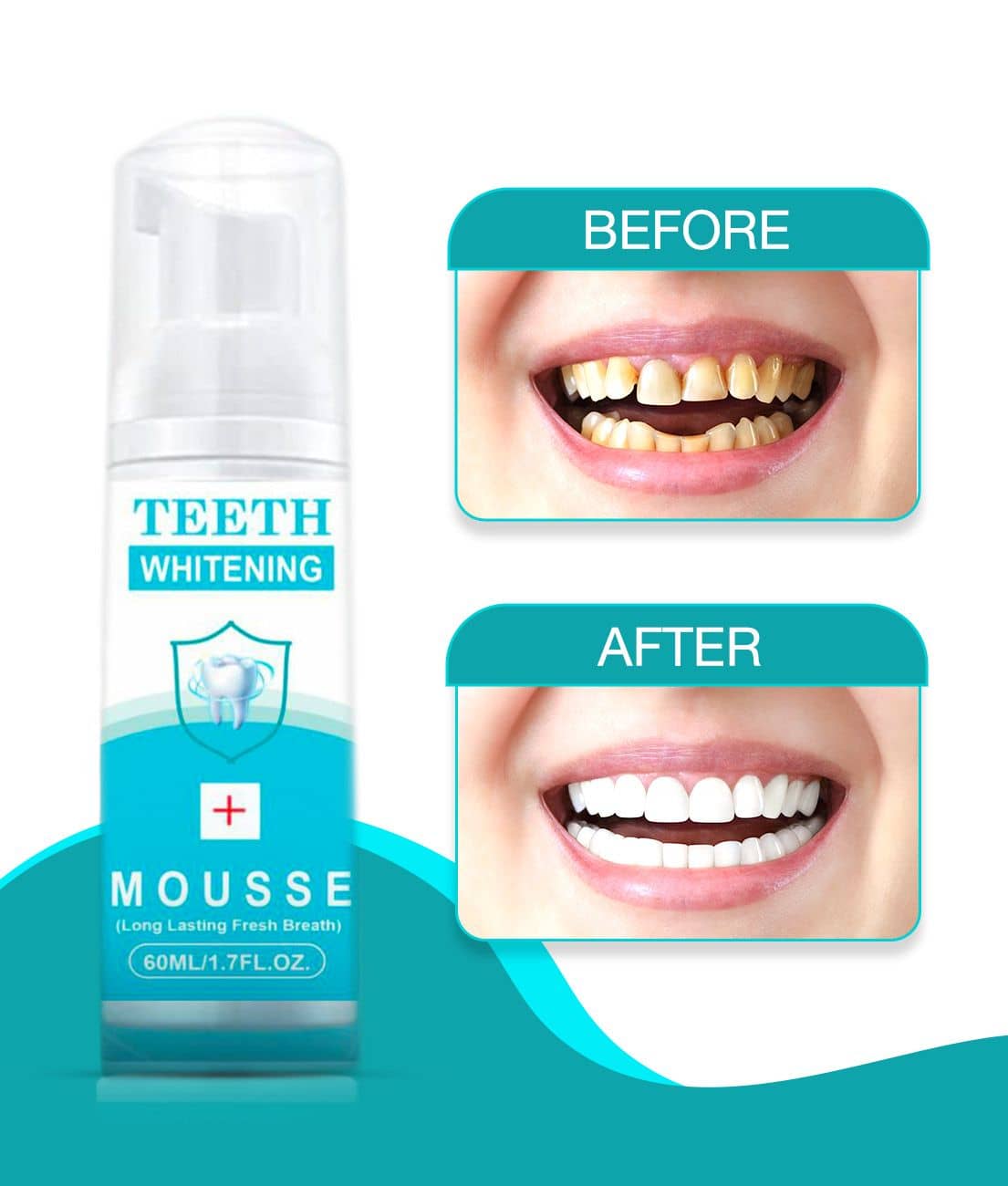 REGOLITH TEETH  WHITENING Denture Oral Kit