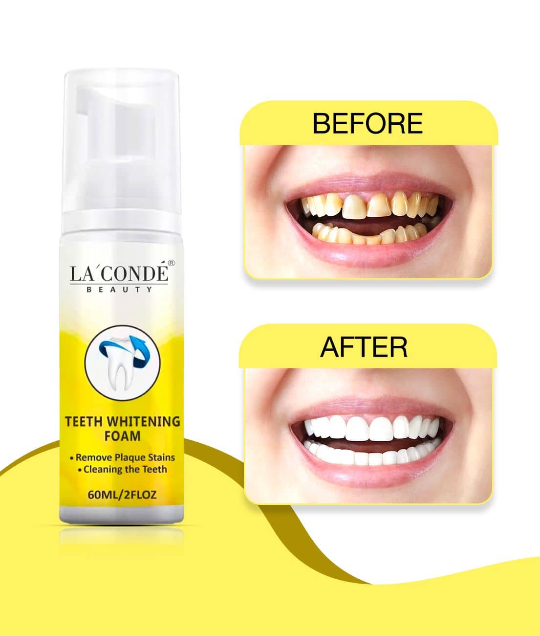 LA' CONDE' Teeth Whitening Foam Remove Stains Denture Oral Kit