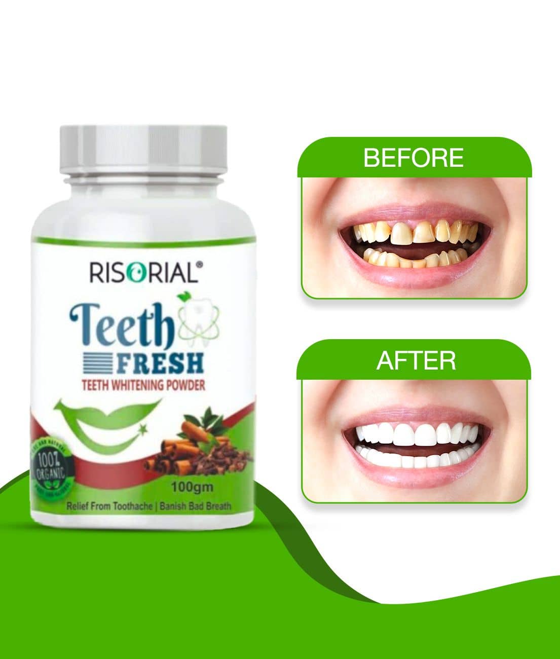 Risorial Teeth Whitening Denture Oral Kit