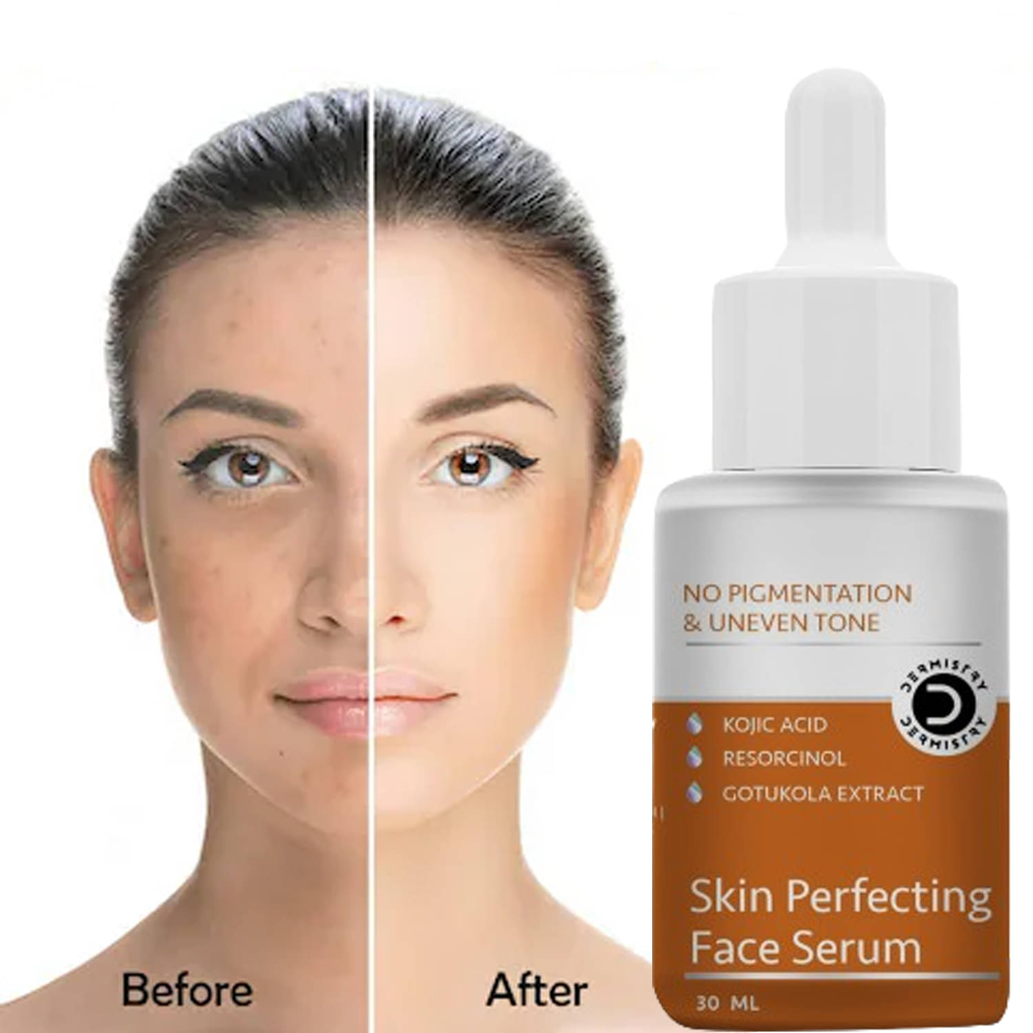     			Dermistry Hyper Pigmentation Fairness Kojic Acid Face Serum Skin D Tan Whitening Lightening Brightening Shine Care Anti Blemishes Pigment Melasma Removal Glowing Beauty Moisturizer Goree Gora Lotion Cream Pack Scrub Facial Kit Bleach Cleanser Mask-30ml