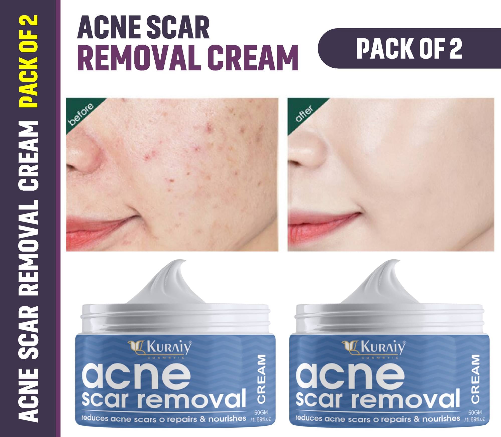     			KURAIY Scar Removal Cream Repair Stretch Marks Burn Acne Scar Pack of 2