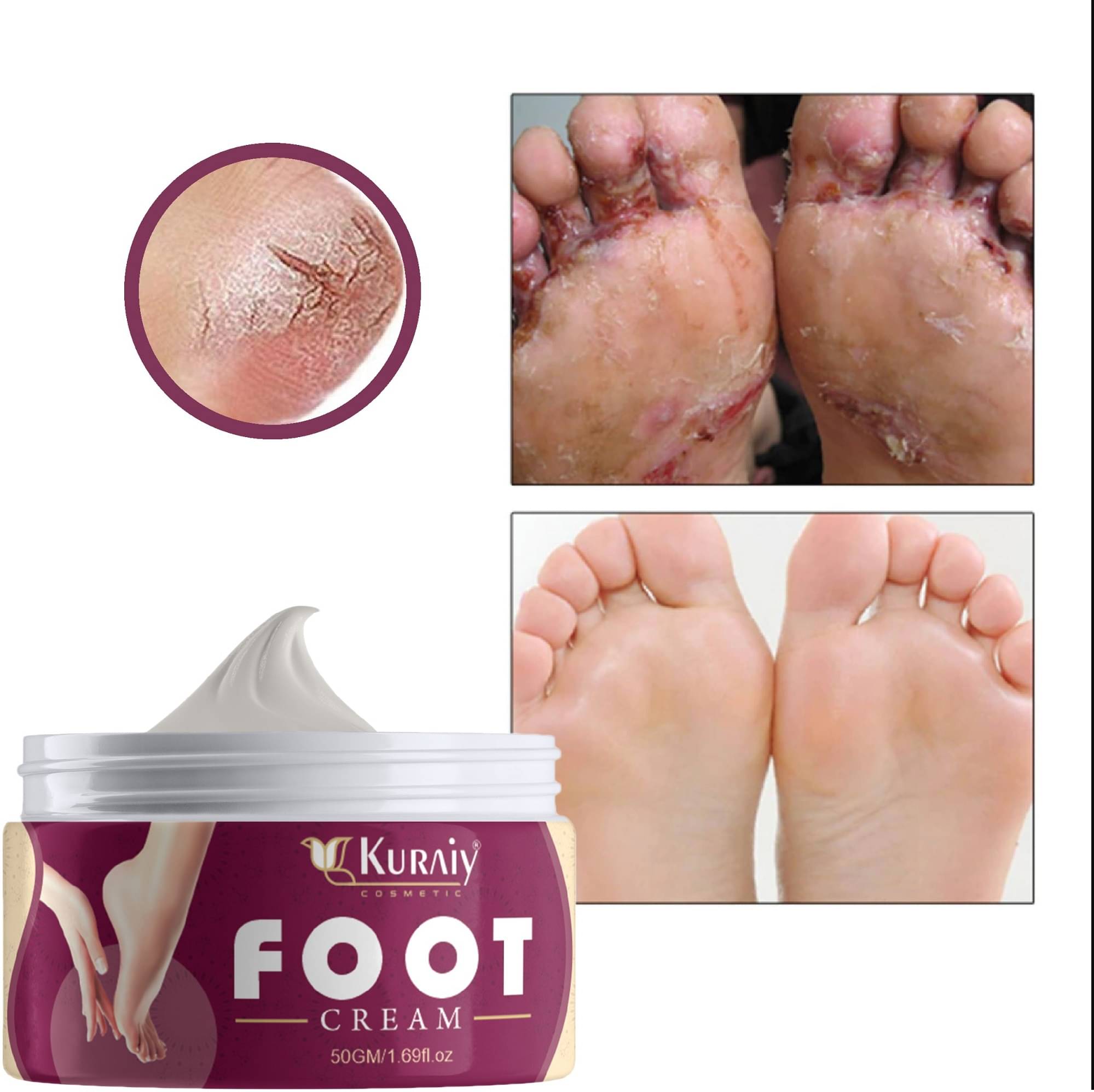     			KURAIY Foot Cream ( 50 g )