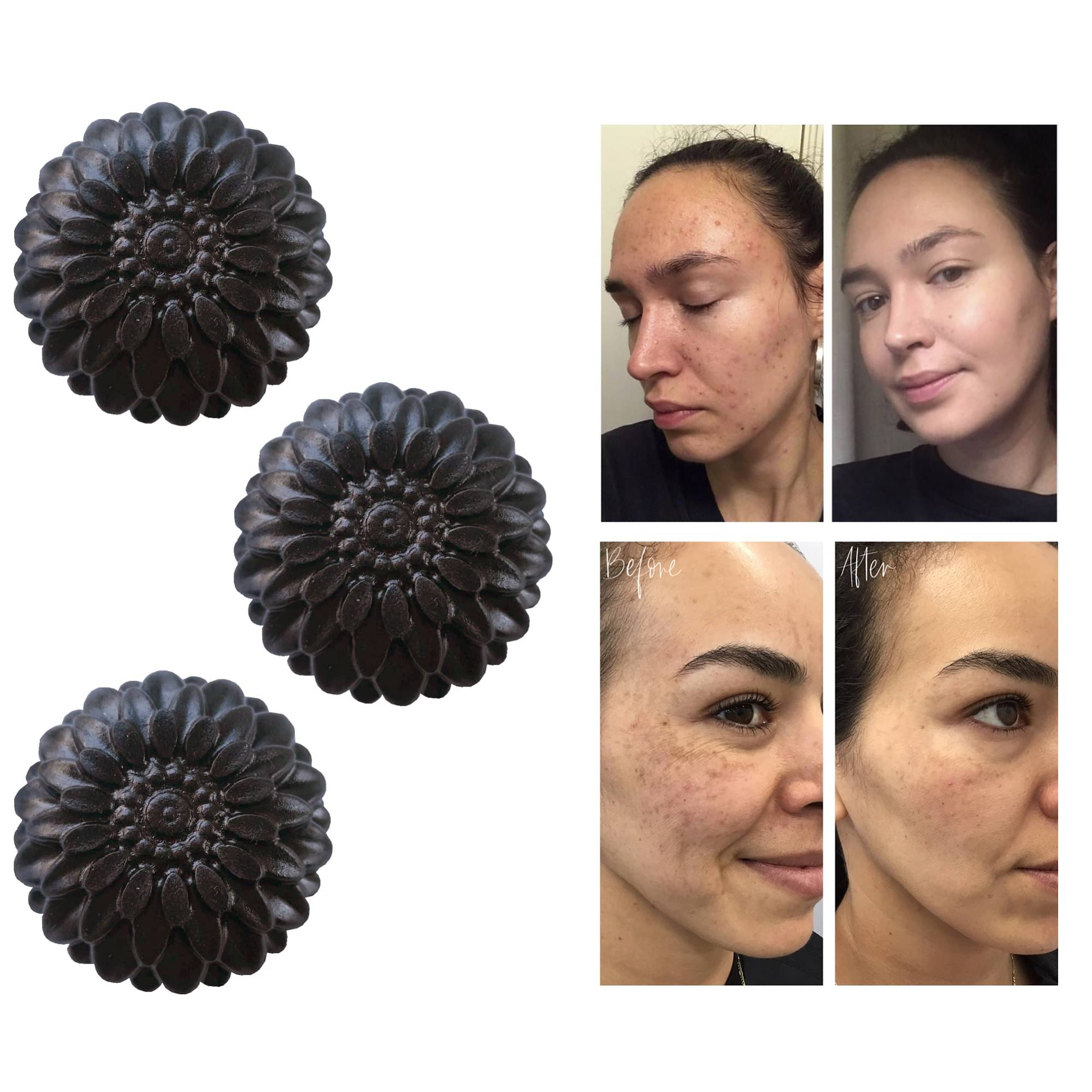     			KURAIY Freshness Bar for All Skin Type ( Pack of 3 )