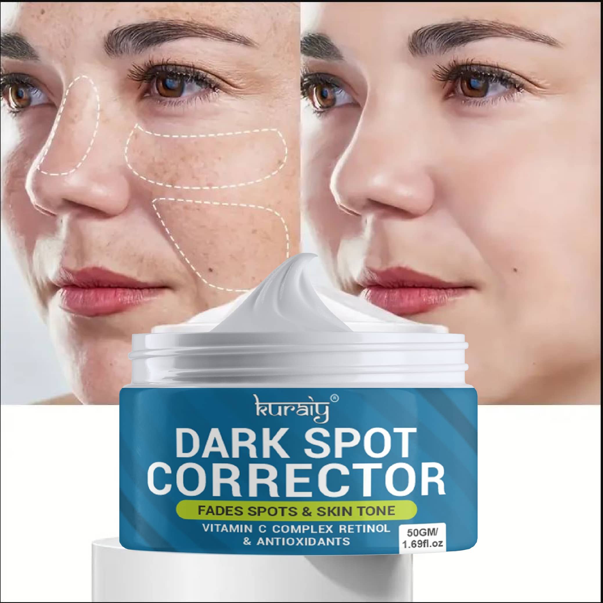 KURAIY Dark Spot Remover Face Body Whitening Brightening Skin Freckles 50g