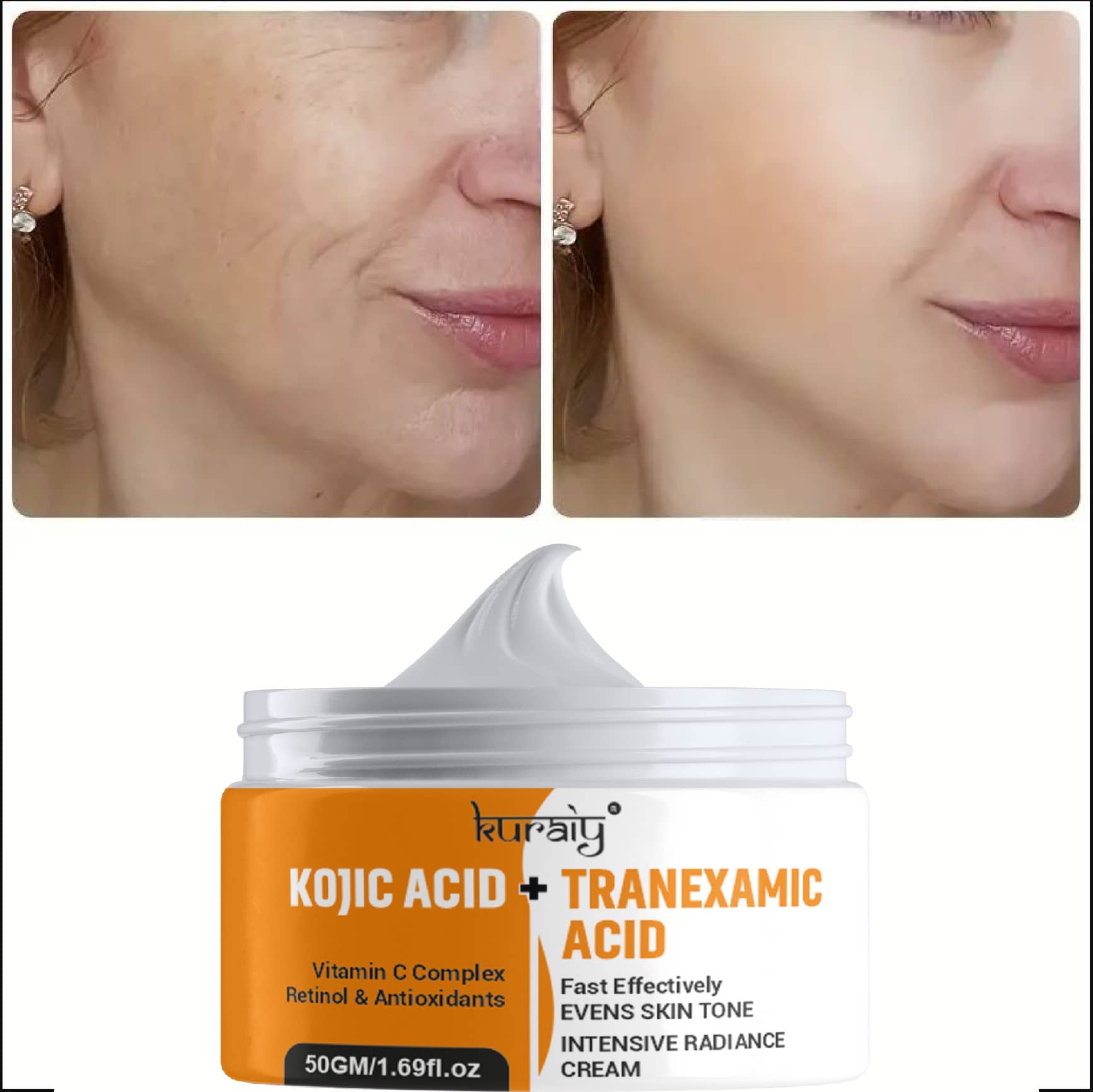 KURAIY Kojic Acid whitening cream Kojic Acid Wrinkle removal Acne scar pigment cream