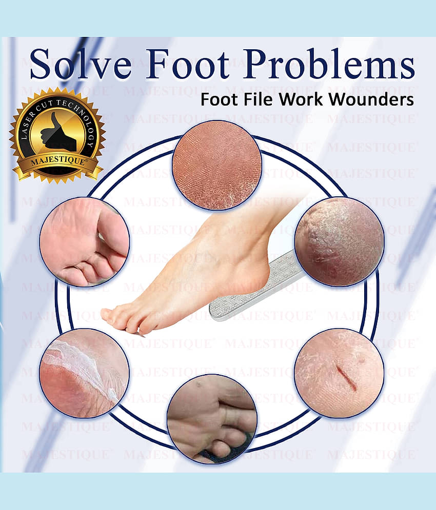 Majestique Callus Remover Foot Scrubber Foot Files Dead Skin Callus Rasp Scrubber (Multicolor)