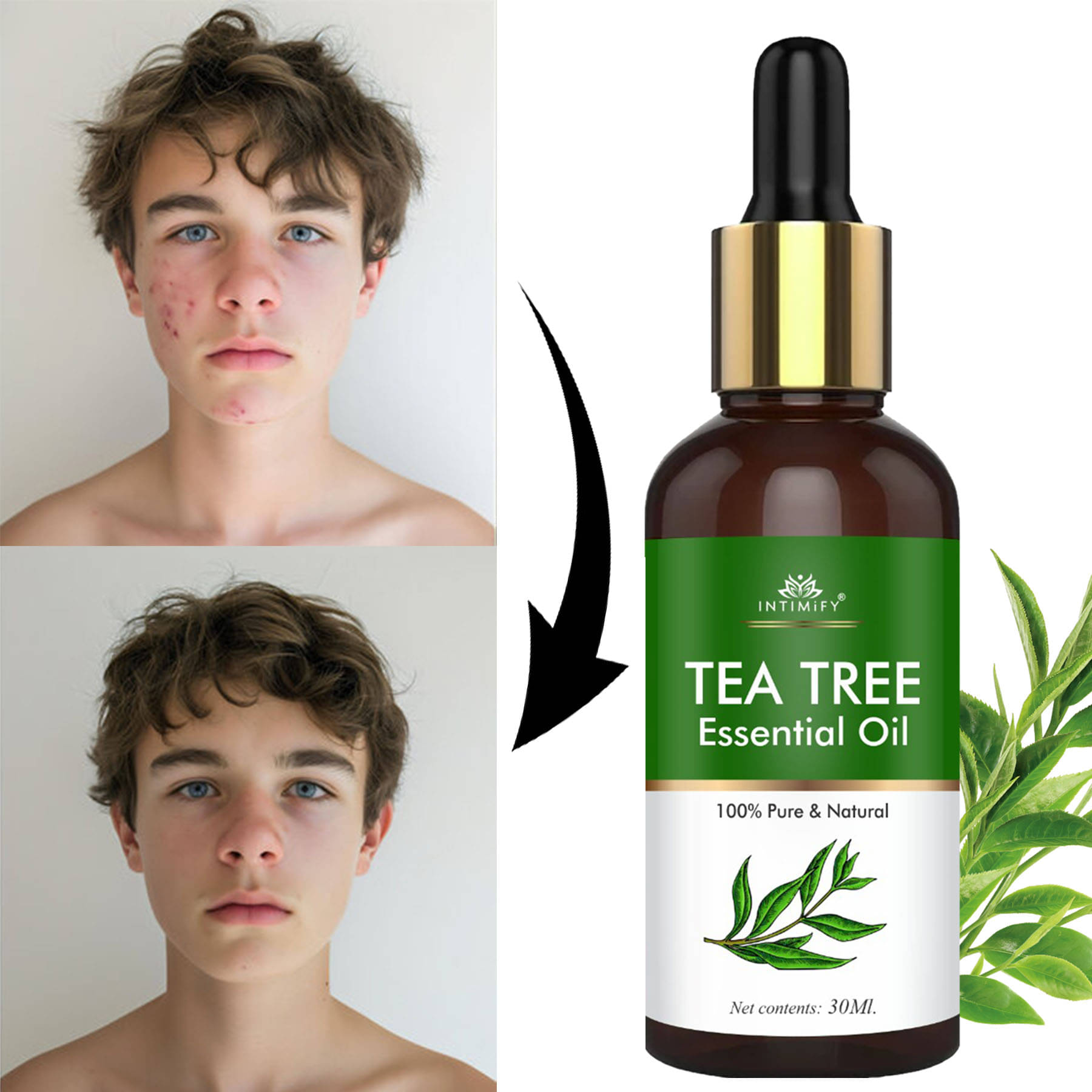 Intimify Tea Tree Essential Oil, Anti Acne Face Oil, Face Brightening & Whitening 30 mL Intimify Tea Tree Essential Oil, Anti Acne Face Oil, Face Brightening & Whitening 30 mL
