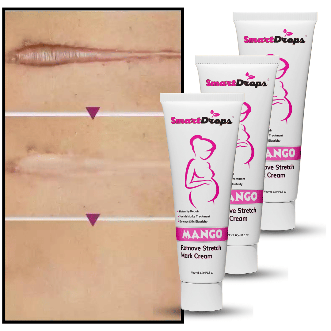     			Smartdrops Anti Aging Cream Fruity ( 180 mL ) Pack of 3