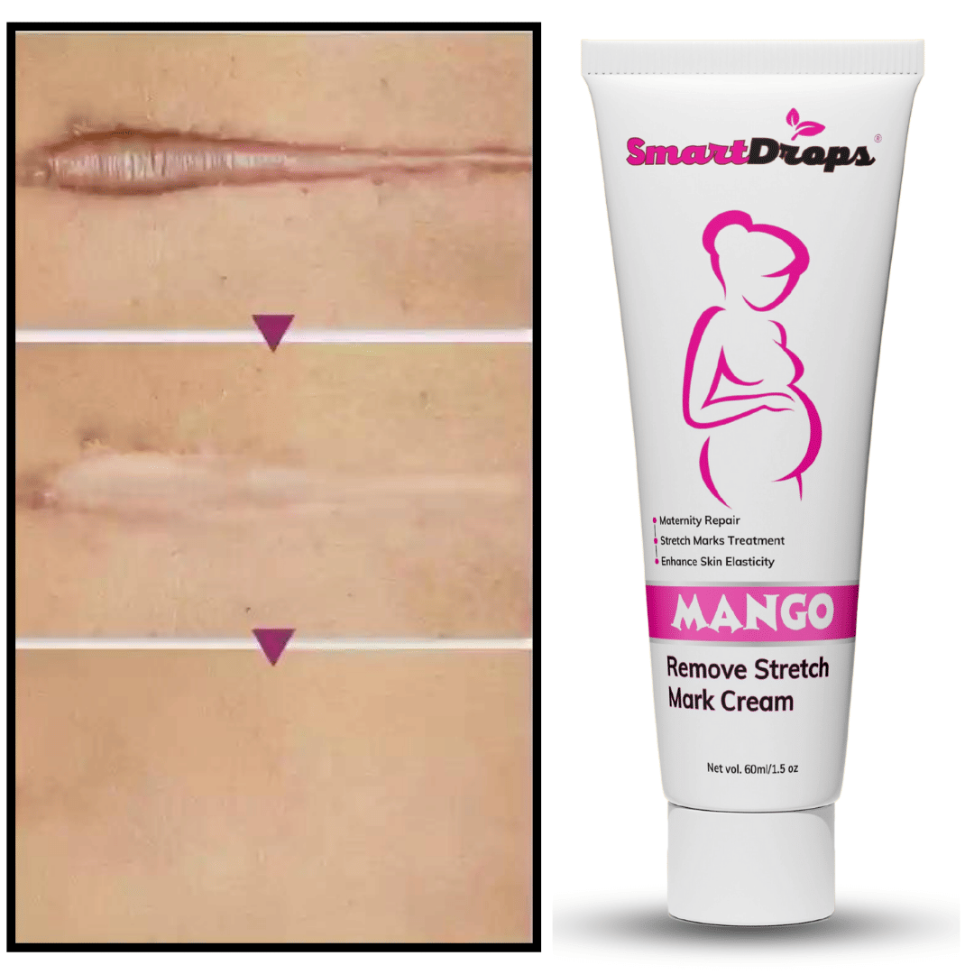 Smartdrops Light weight moisturising Cream Fruity ( 60 mL )