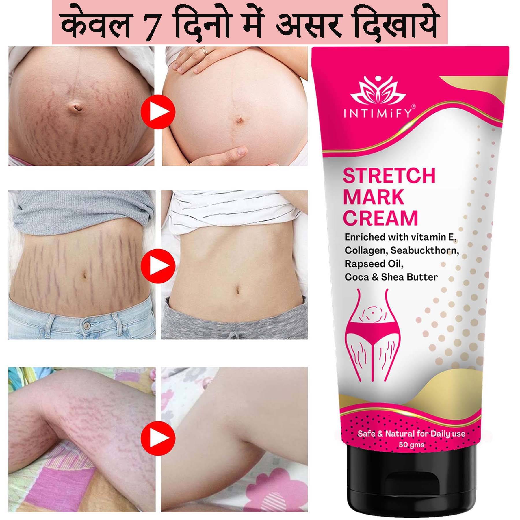     			Intimify Stretch Mark Remover Cream, Stretch Mark Cream, Shaping & Firming Cream 50 gms