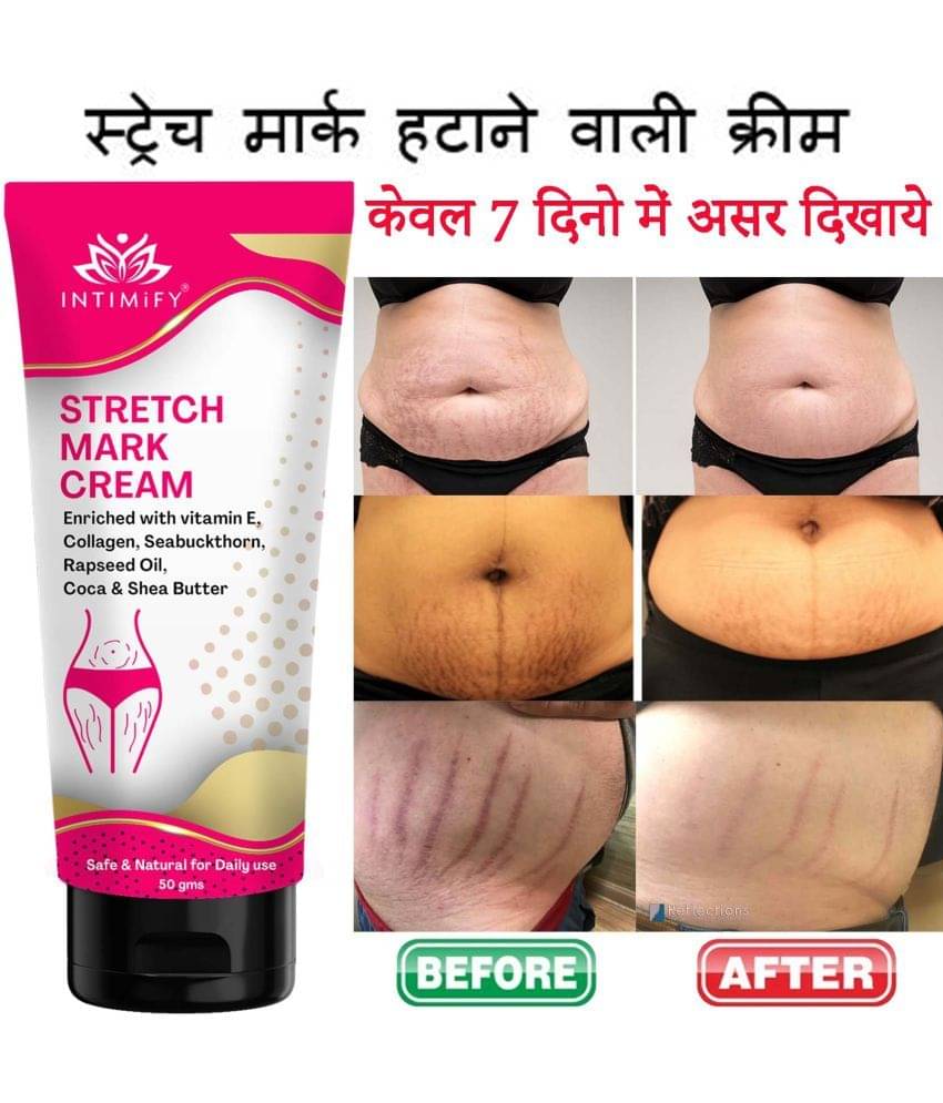     			Intimify Stretch Mark Cream, Stretch Mark Removal Cream, Shaping Cream & Firming Cream, 50 gms