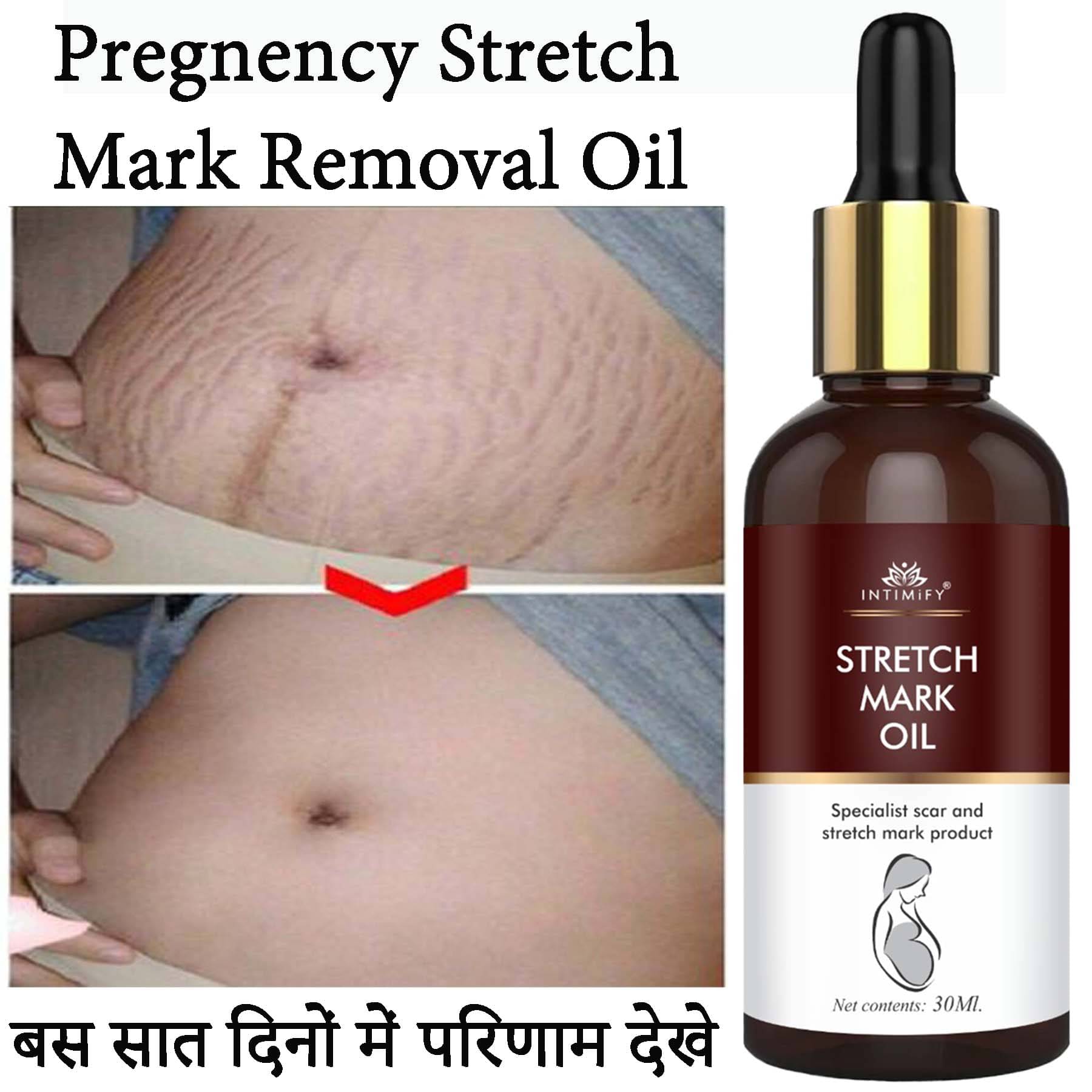 Intimify stretch mark remover, stretch mark massage oil, Shaping & Firming Oil, 30 mL Intimify stretch mark remover, stretch mark massage oil, Shaping & Firming Oil, 30 mL