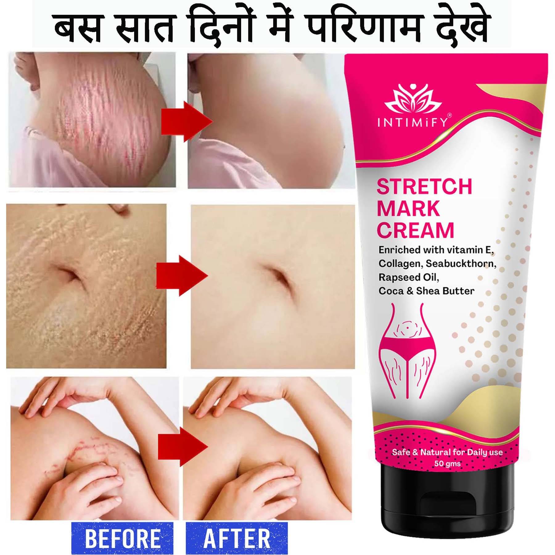     			Intimify Stretch Mark Cream, Stretch Mark Remover Cream, Shaping & Firming Cream 50 gms