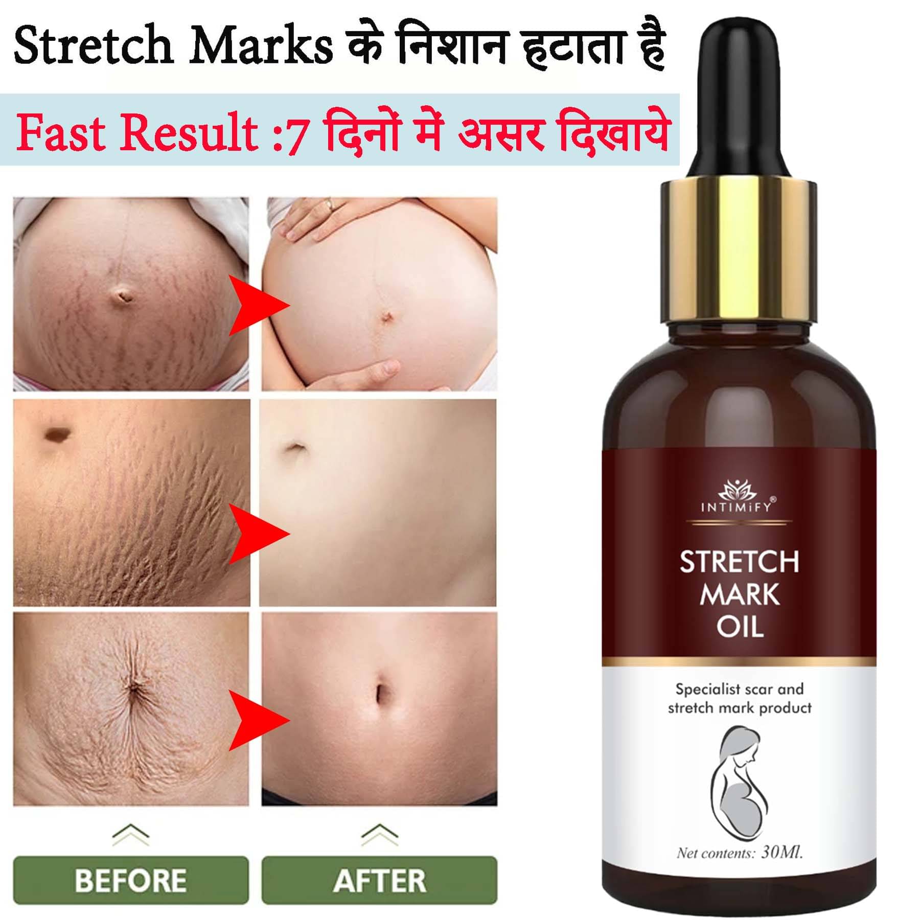     			Intimify Stretch Mark Remover oil, stretch mark massage oil, Shaping & Firming Oil, 30 mL