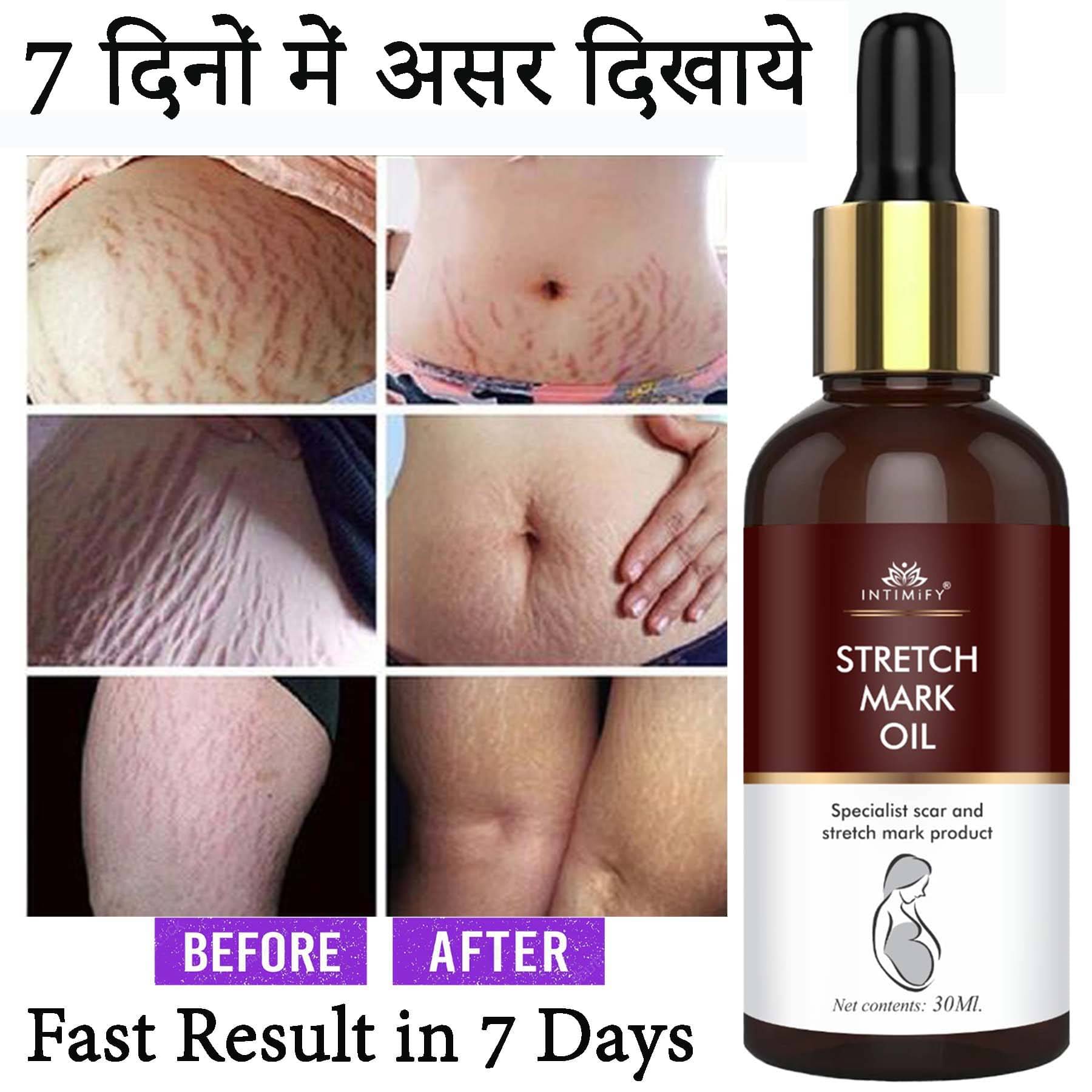 Intimify Stretch Mark Massage Oil, Stretch Mark Remover, Shaping & Firming Oil, 30 mL Intimify Stretch Mark Massage Oil, Stretch Mark Remover, Shaping & Firming Oil, 30 mL