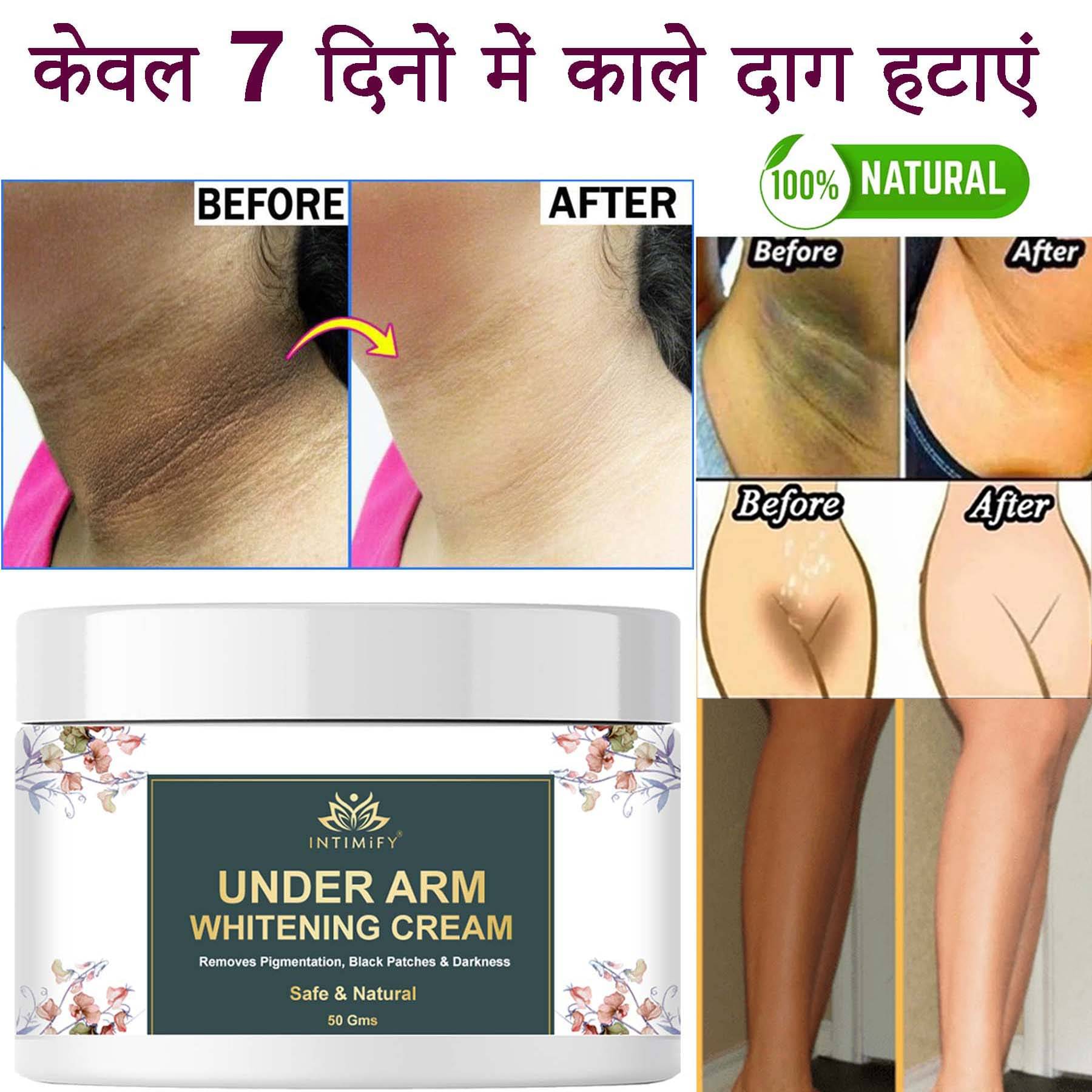     			Intimify Underarm Whitening Cream Goree Cream, Skin Brightening Cream, neck whitening cream 20 gms