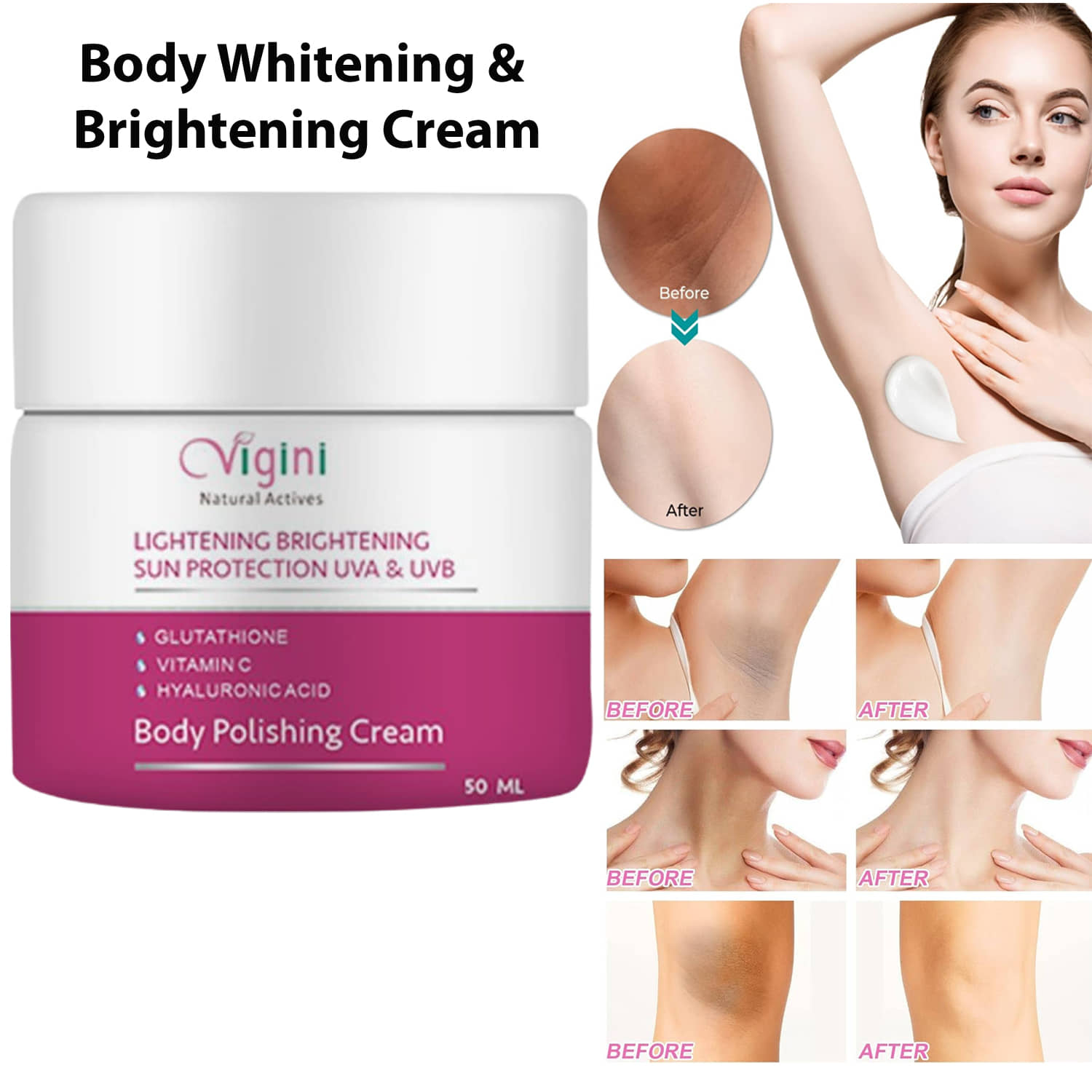 Vigini 100% Natural Actives Skin Lightening Brightening Body Whitening Polishing D Tan Underarm Kojic & Hyaluronic Acid Cream