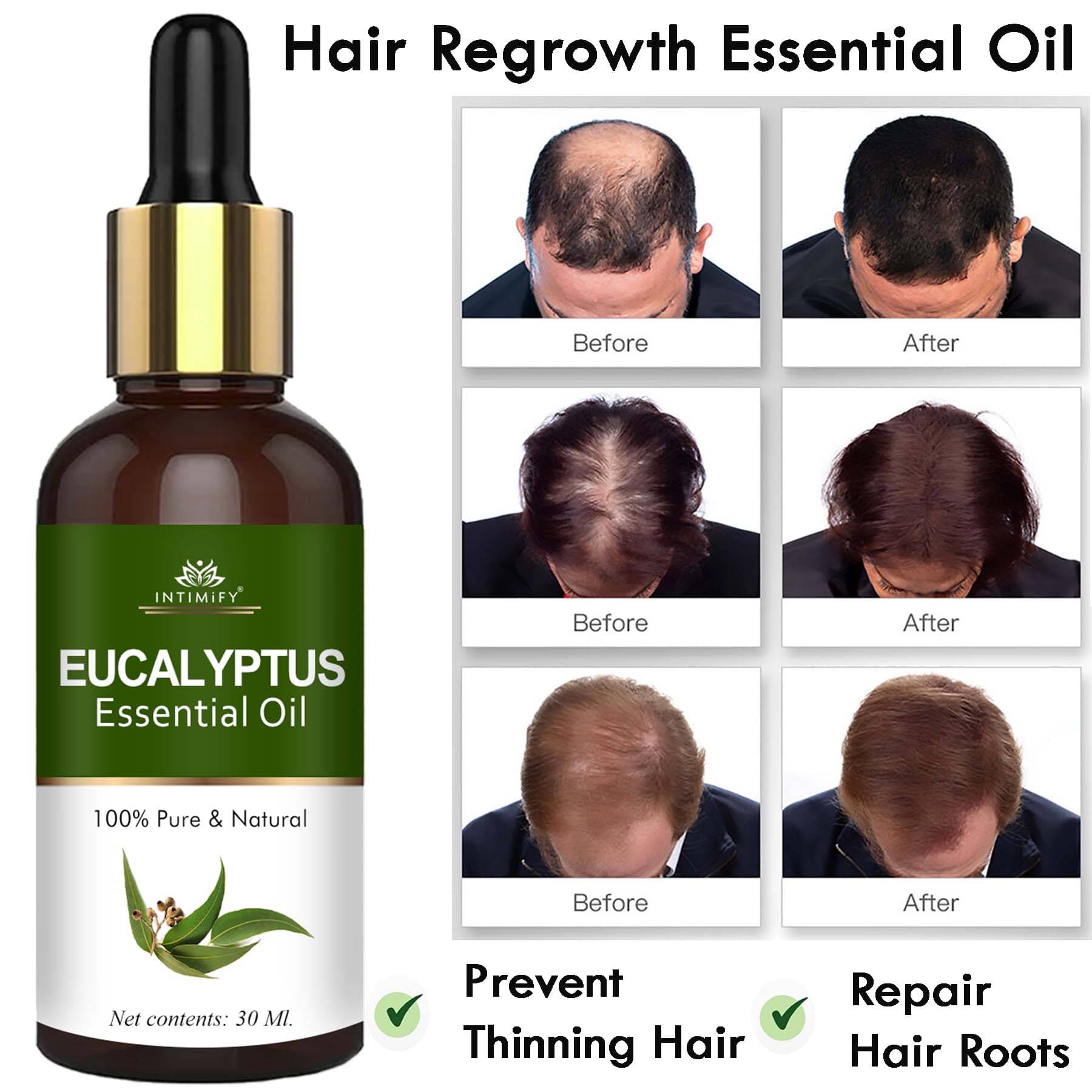 Intimify Eucalyptus Essential Oil, Hair Growth Oil, Hair Inhabiter Oil, Hair Loss Oil, 30 Ml Intimify Eucalyptus Essential Oil, Hair Growth Oil, Hair Inhabiter Oil, Hair Loss Oil, 30 Ml