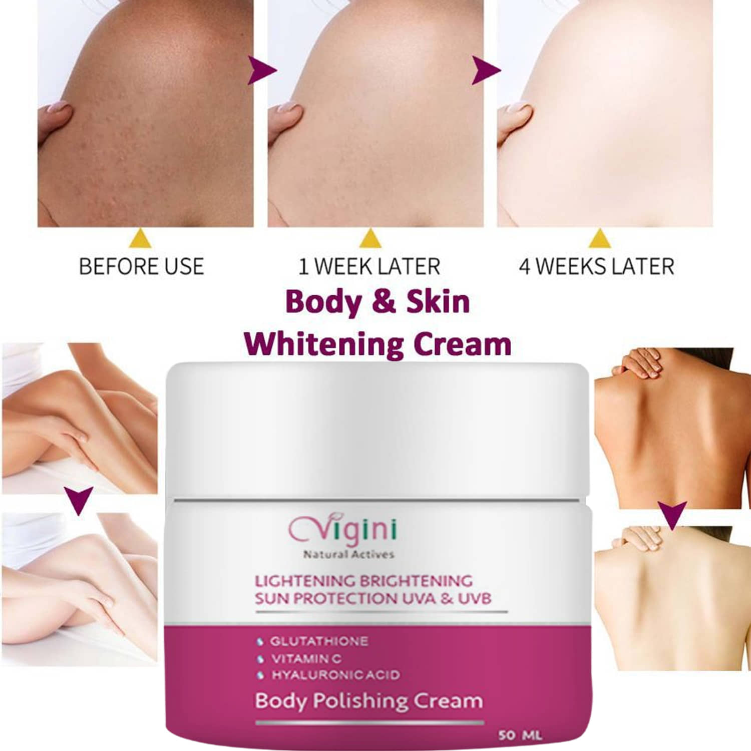 Vigini Body Whitening Cream, white face cream, skin whitening cream, skin shine, underarm whitening cream, gor@ee cream (50 gms)