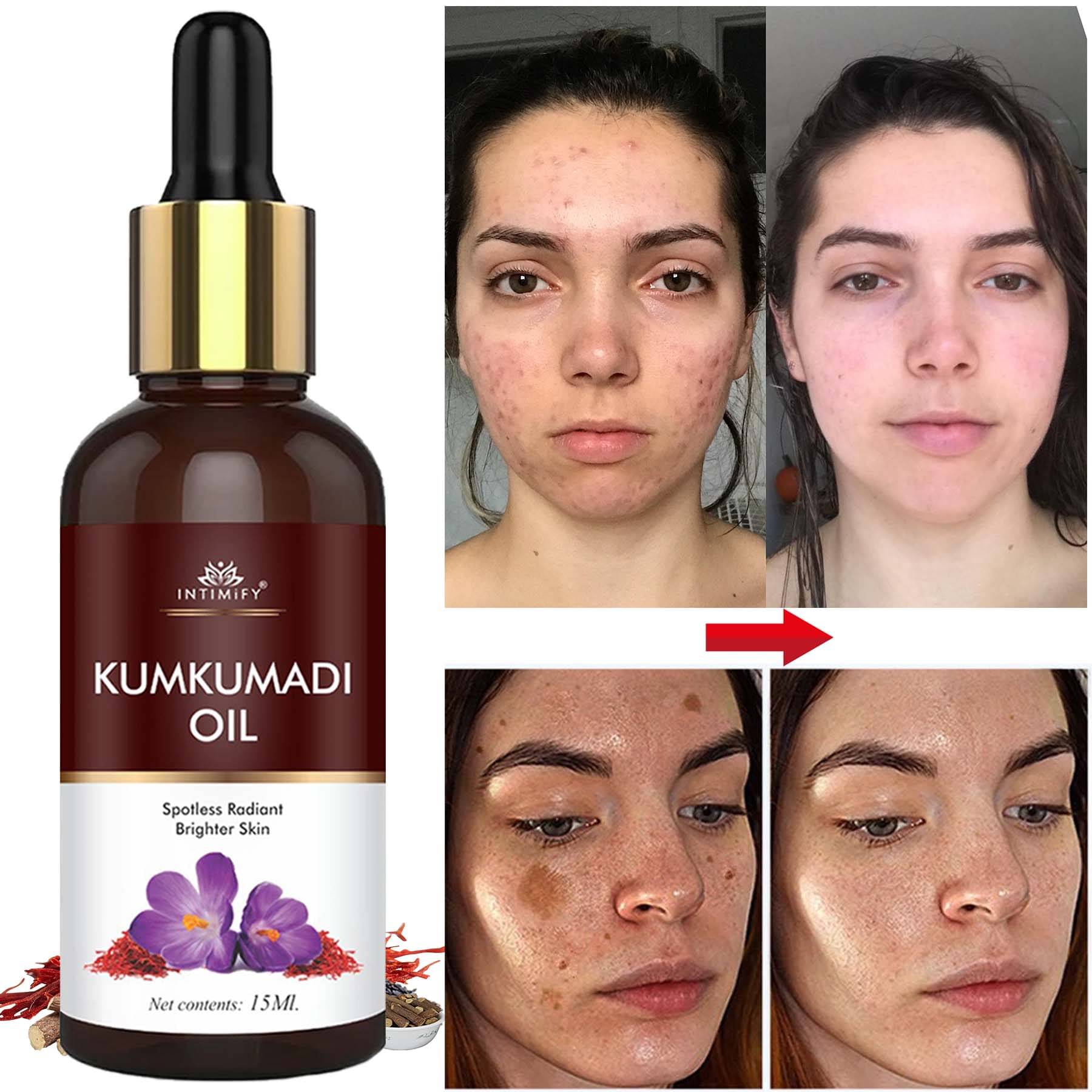 Intimify Kumkumadi Oil, Kumkumadi Face Oil For Skin Brightening, Skin Whitening, 30 Ml Intimify Kumkumadi Oil, Kumkumadi Face Oil For Skin Brightening, Skin Whitening, 30 Ml