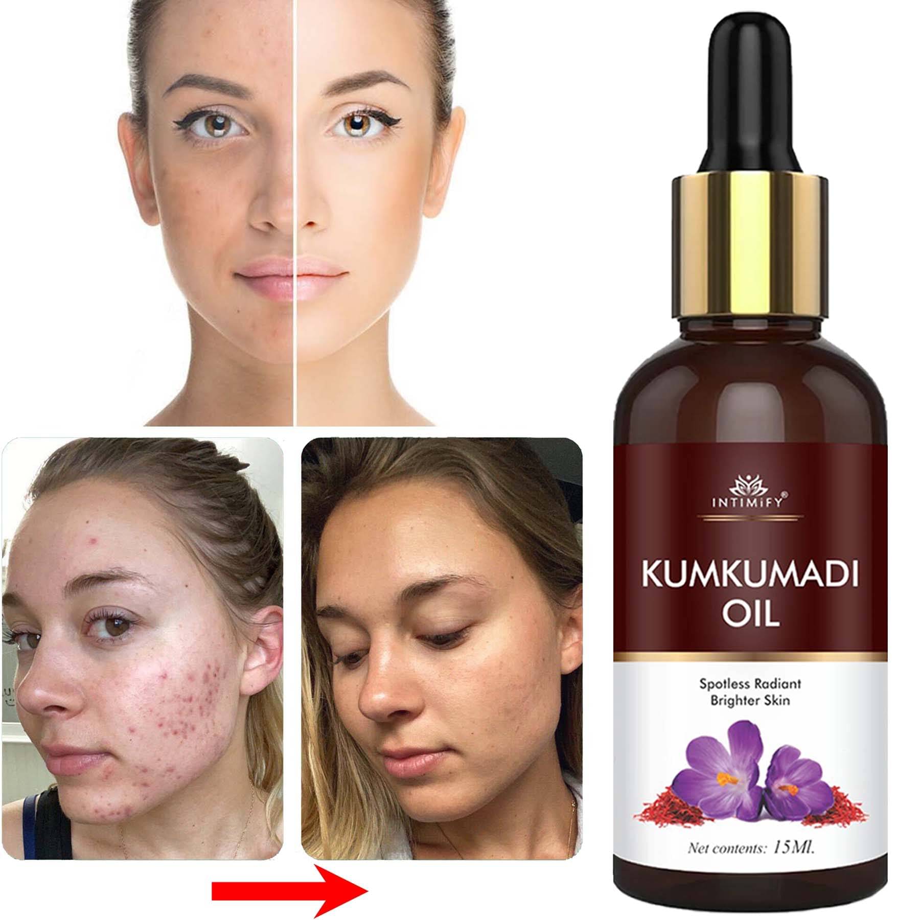 Intimify Kumkumadi Oil, Kumkumadi Face Oil For Skin Brightening & Glowing Skin, 30 Ml Intimify Kumkumadi Oil, Kumkumadi Face Oil For Skin Brightening & Glowing Skin, 30 Ml