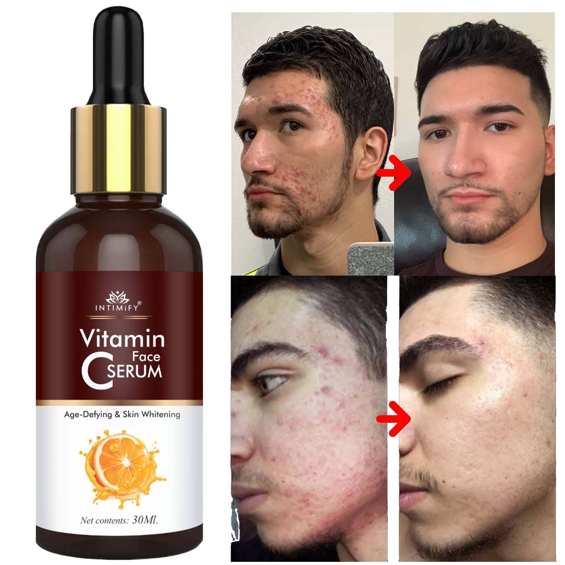    			Intimify Face Serum Vitamin C Skin Toning For All Skin Type, Anti Acne Serum, 30 Ml