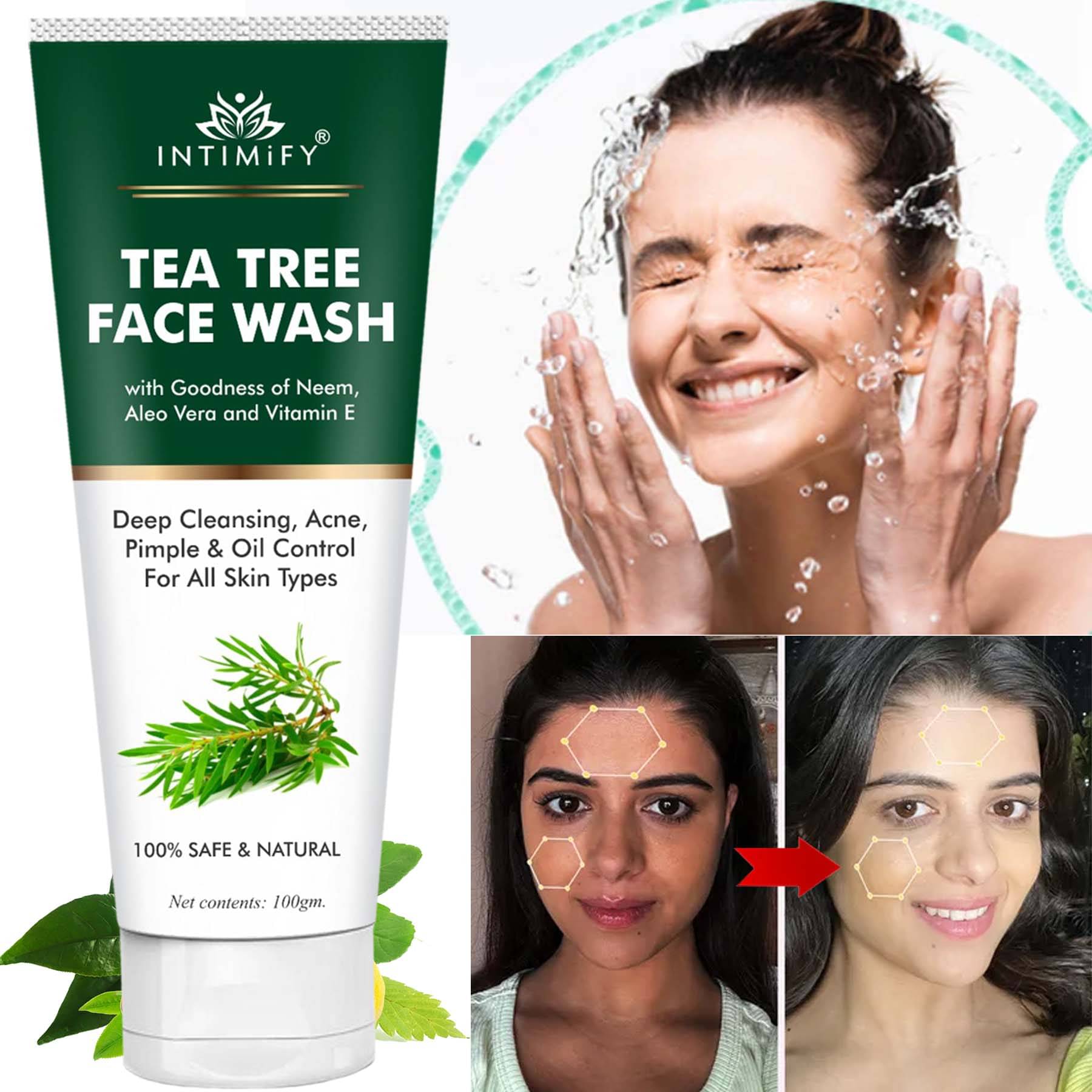 Intimify Tea Tree Face Wash, Oil Removal Face Wash, Tan Removal Face Wash, 100 Gms Intimify Tea Tree Face Wash, Oil Removal Face Wash, Tan Removal Face Wash, 100 Gms