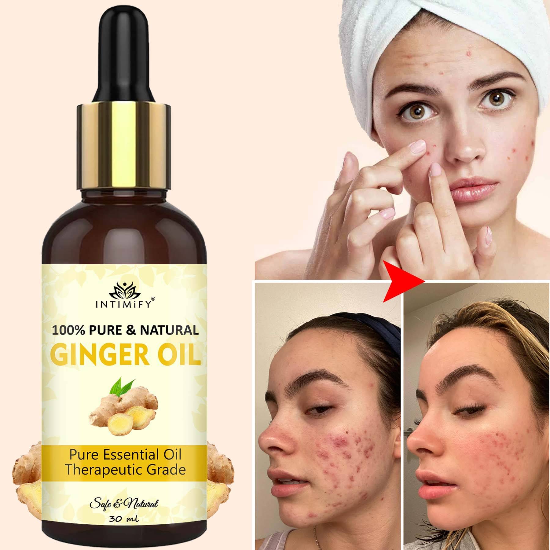     			Intimify Ginger Essential Oil, Anti Acne Oil, Skin Brightening, Skin Shine, Goree, 30 Ml