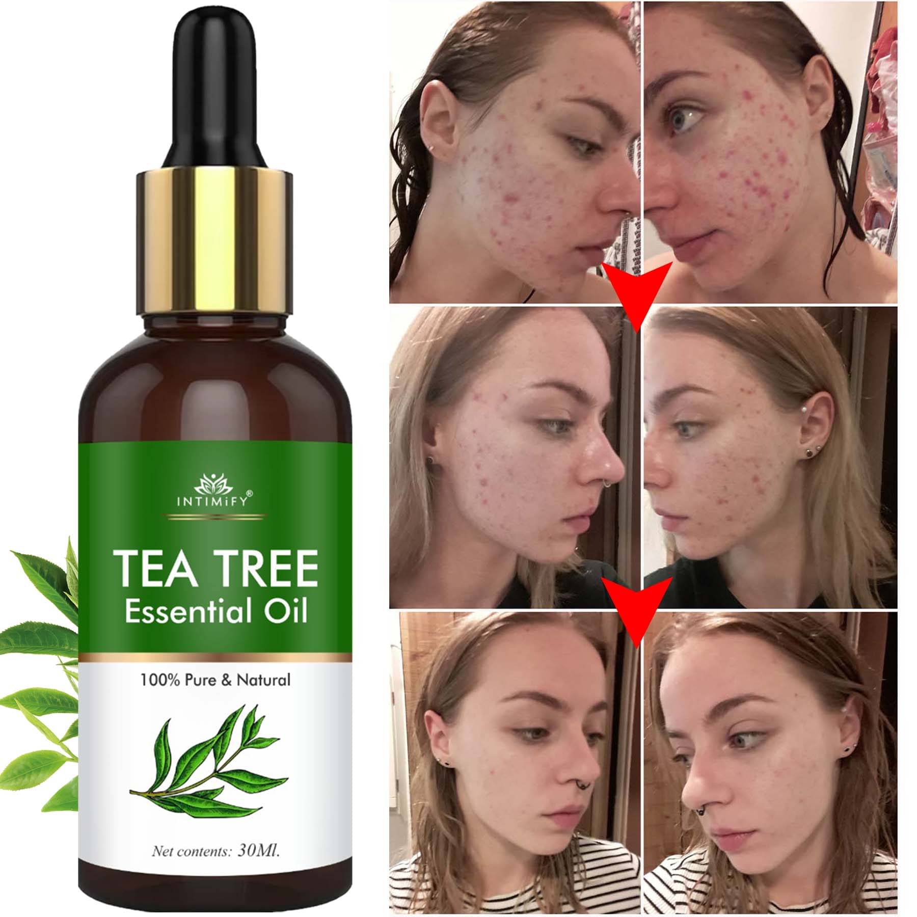 Intimify Tea Tree Essential Oil, Anti Acne Face Oil, Anti Ageing Face Oil, 30 Ml Intimify Tea Tree Essential Oil, Anti Acne Face Oil, Anti Ageing Face Oil, 30 Ml
